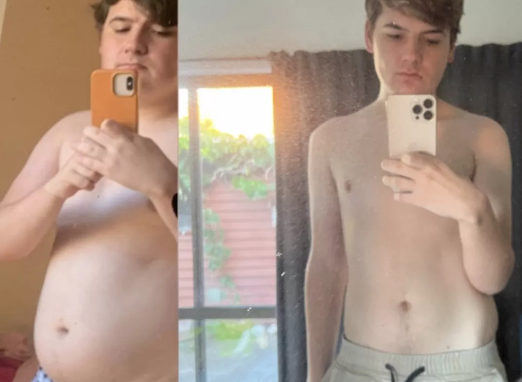 19 y/o. Before and After 50 pounds weight loss