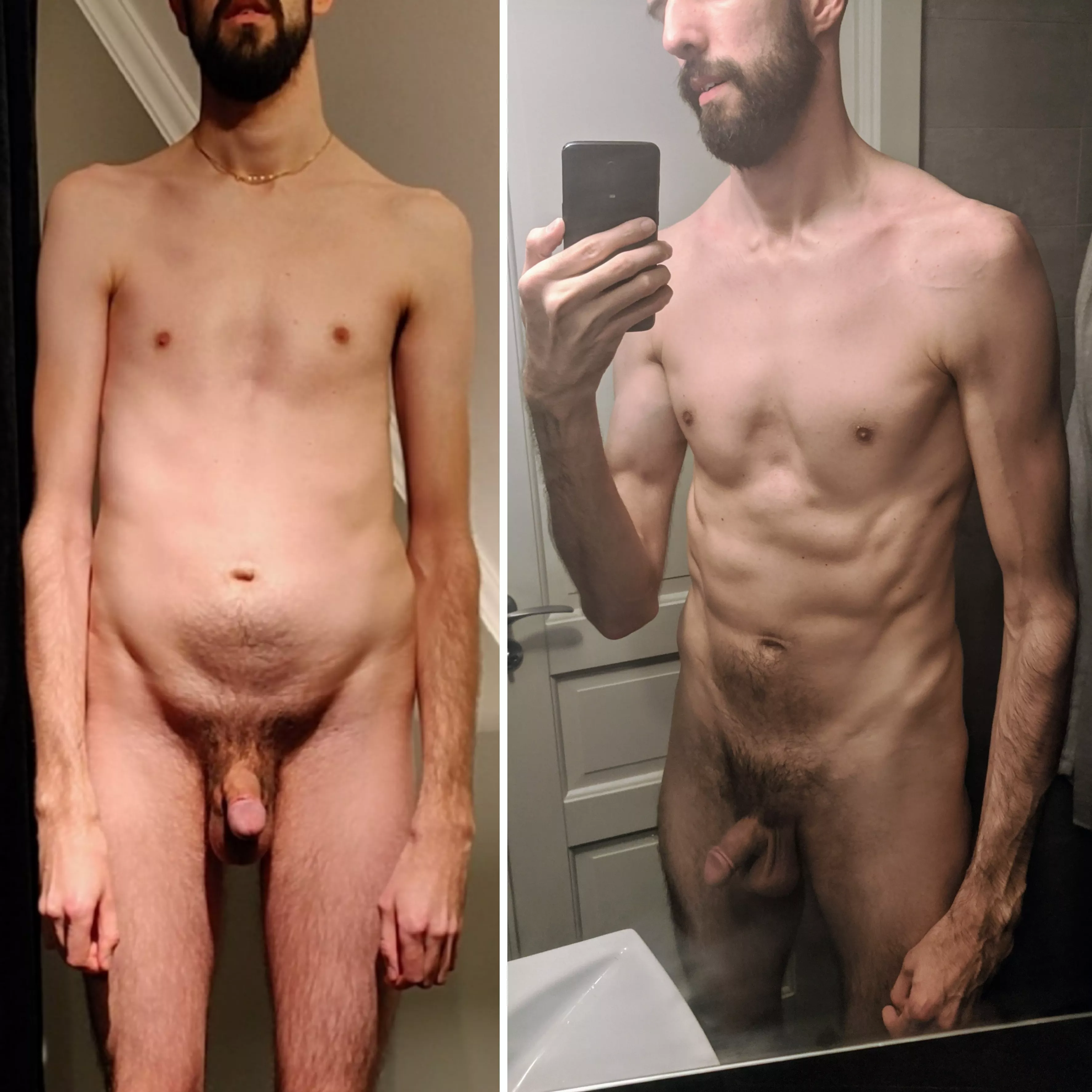 198cm, 71kg, 30yrs [M]arfan's Syndrome. I never want to go back to feeling like I did in the left pic again.