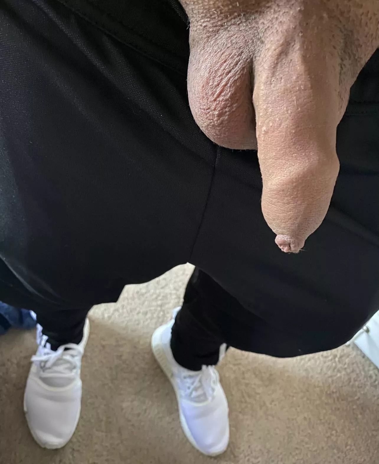 [24] My small flaccid uncut penis.