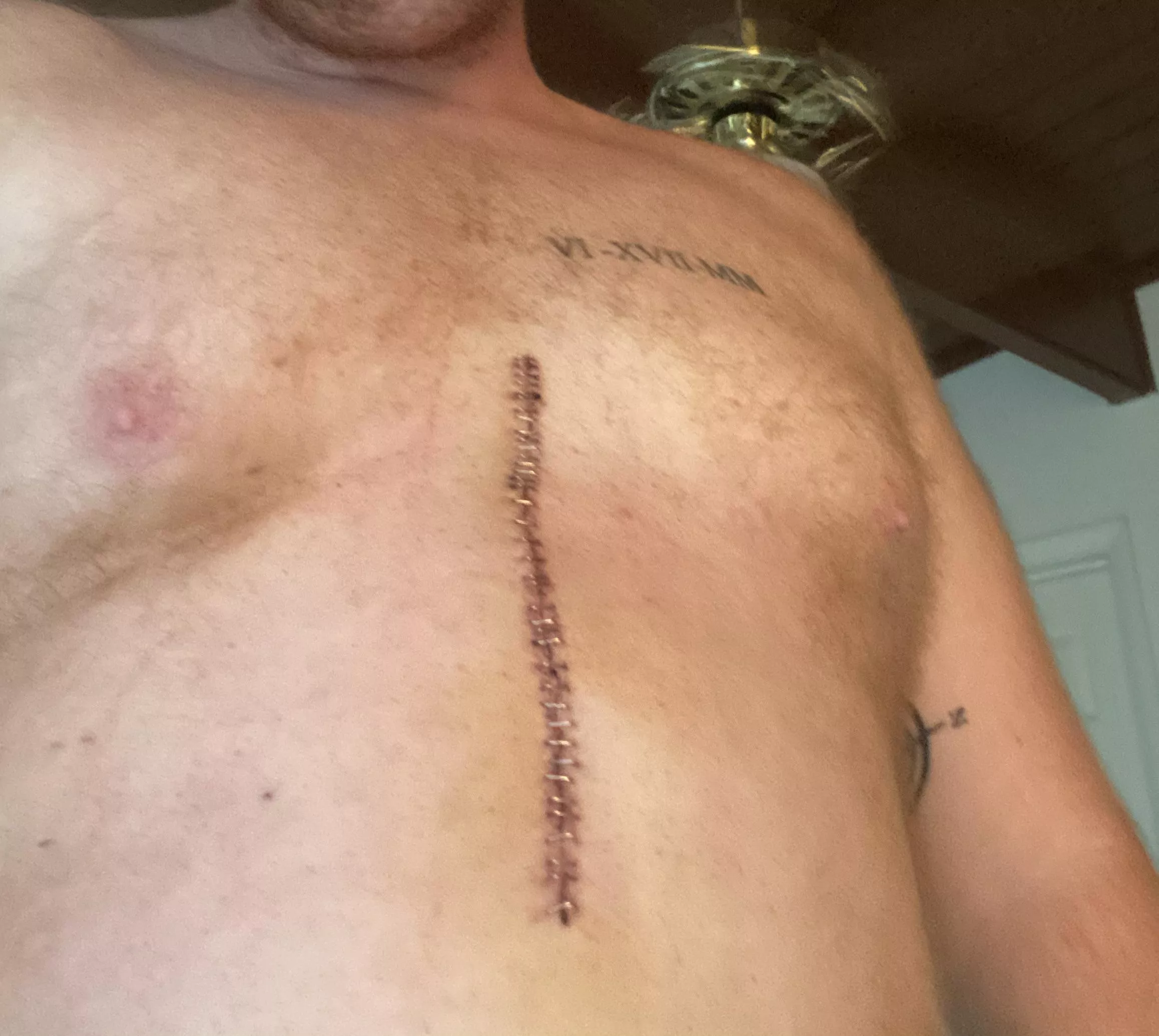 26M thats gonna leave a scar