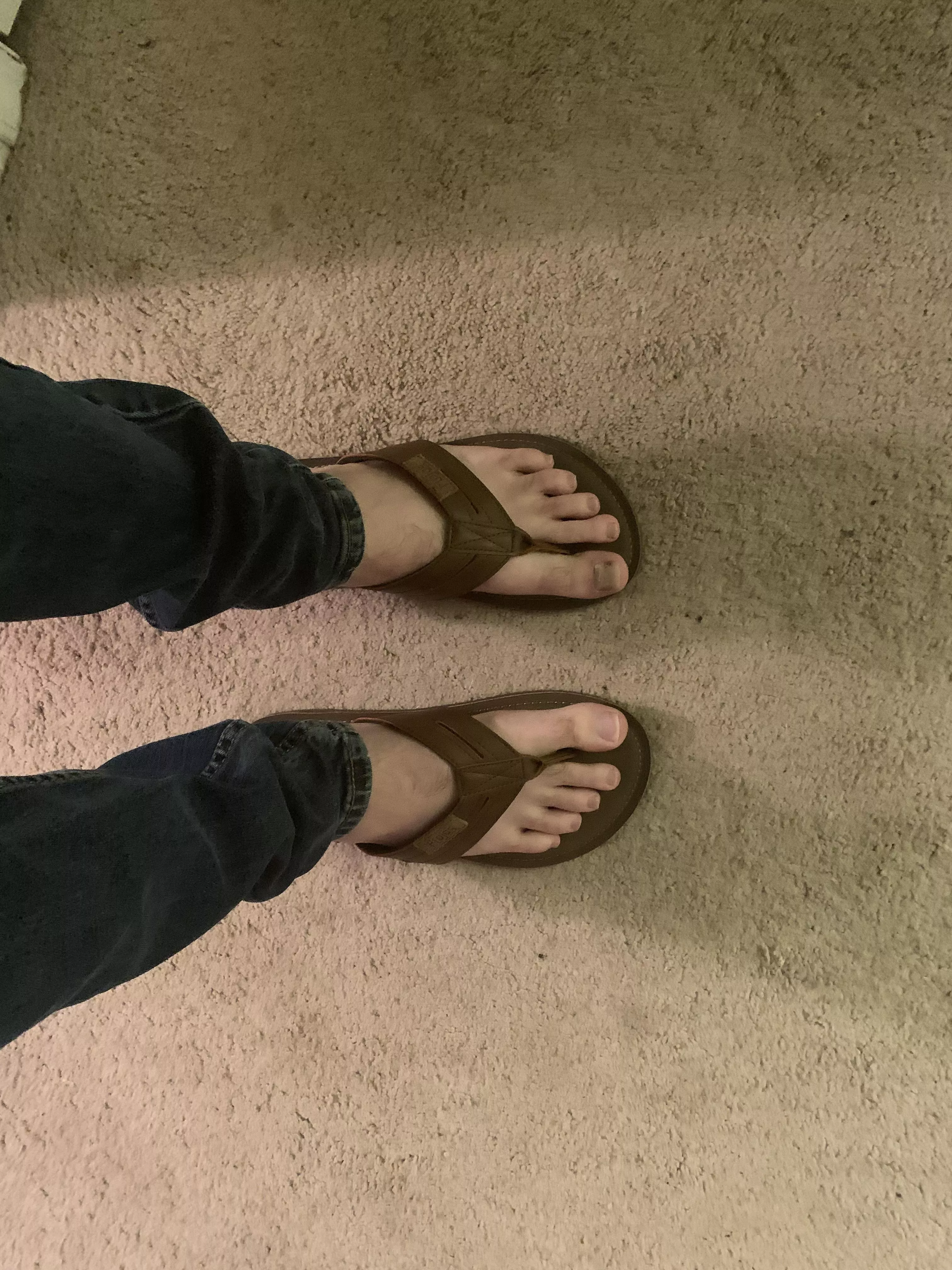 30 does my feet look good with these.. i broke my toe a few months ago