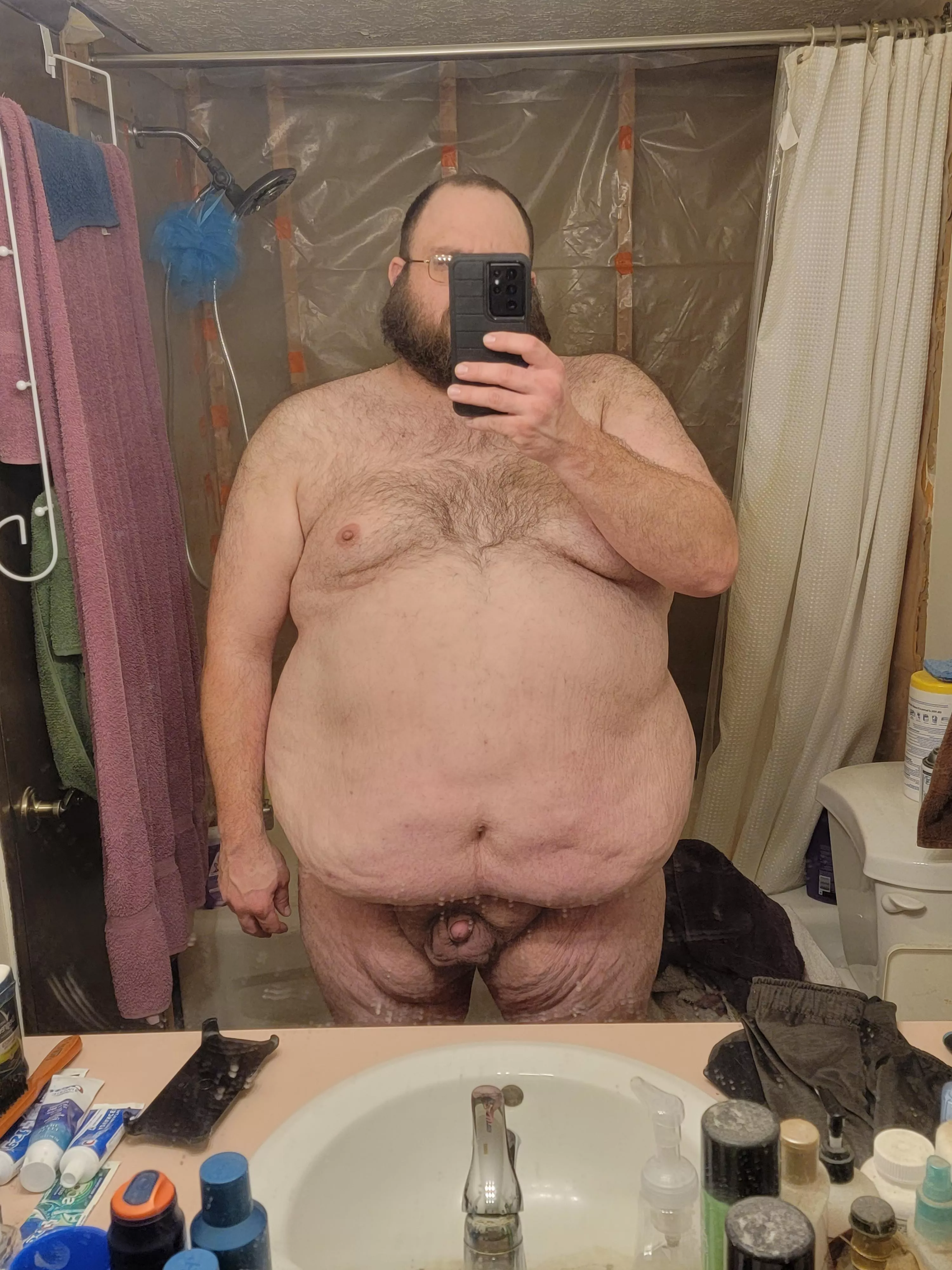 35, M, 6ft, 395lbs. Very insecure about my body. Feel like I'm not attractive enough for anyone