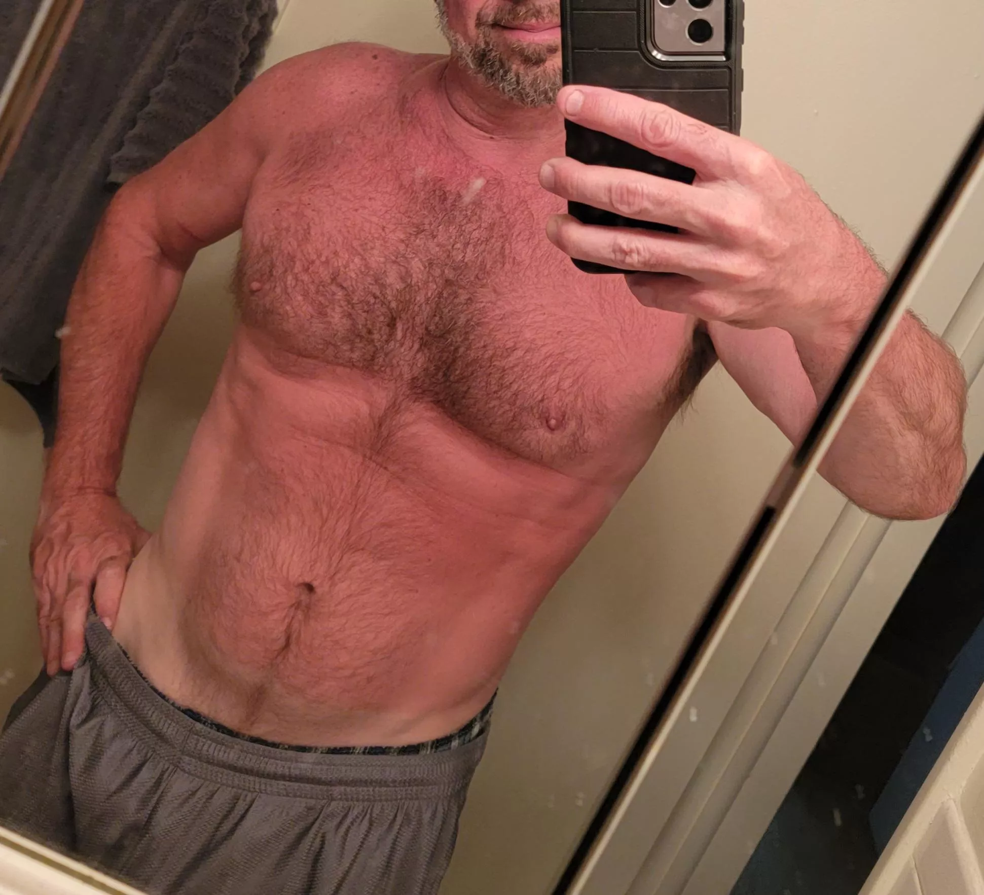 [51][OC] Can someone rub some aloe on me... gently?