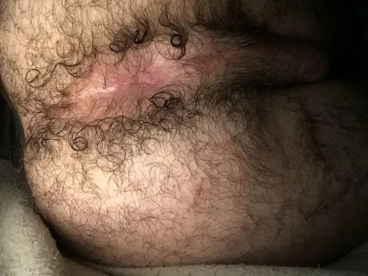 A bit hairy