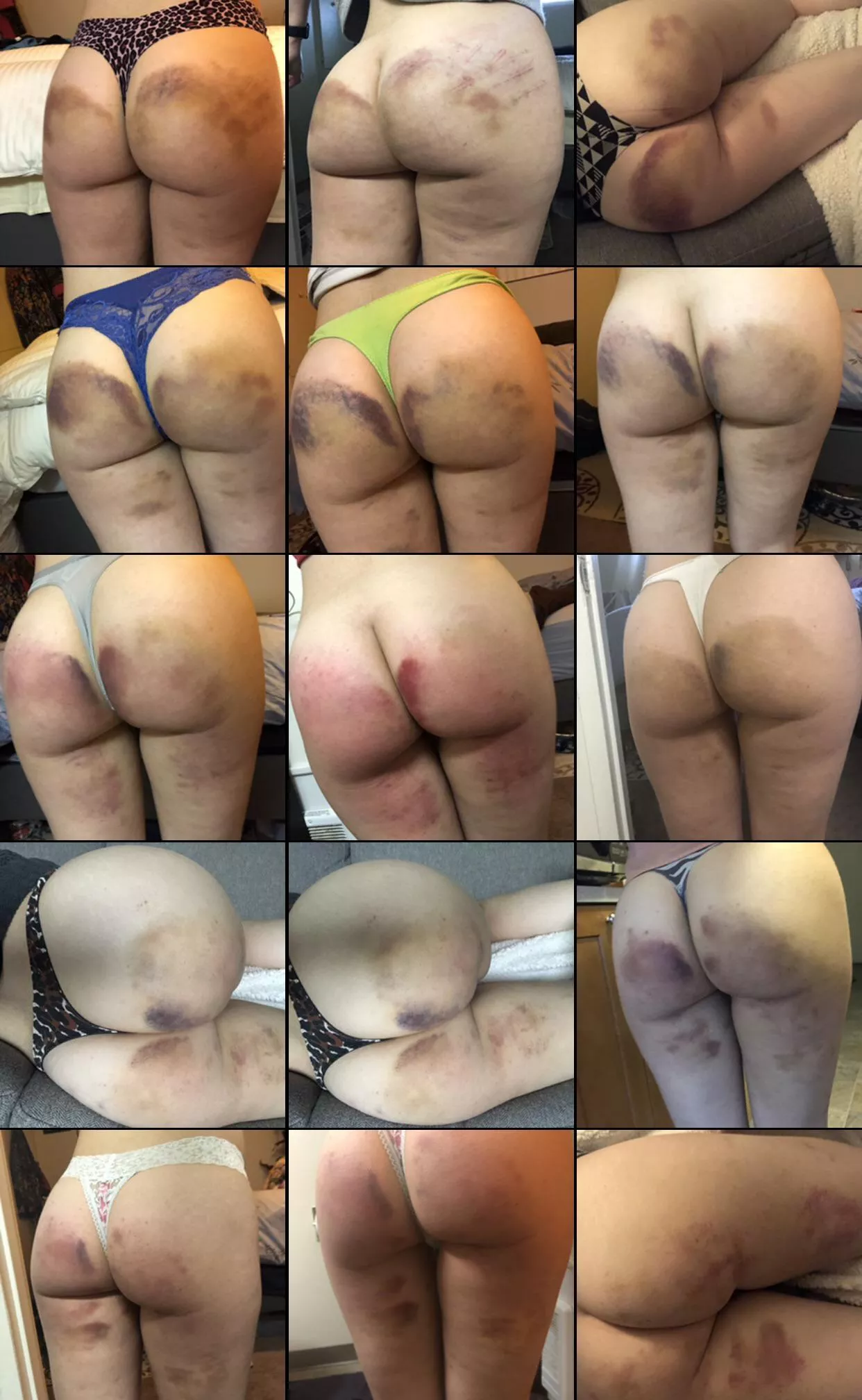 A compilation [F]rom when I actually used to bruise easily 😭😍