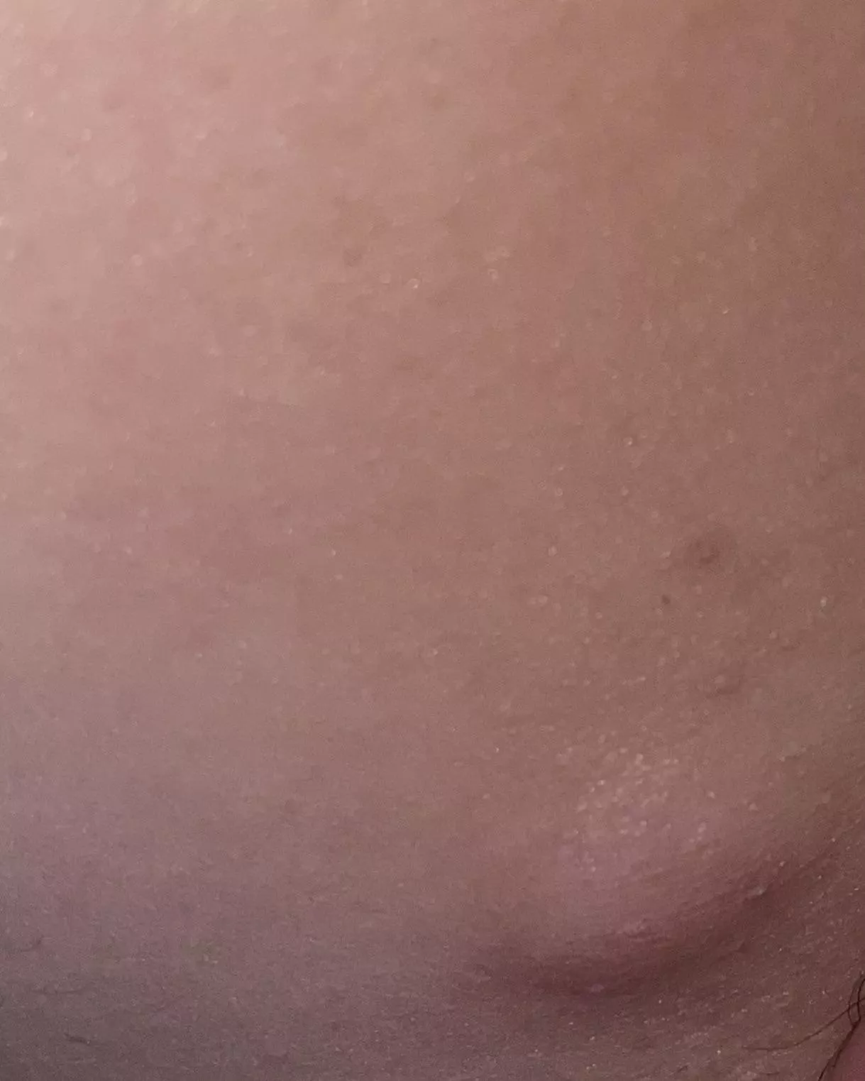 Any idea what this is? Iâ€™ve been to the doctor about two years ago and she said it felt okay. Itâ€™s got bigger since and hurts more. Itâ€™s on the inner side of my groin/leg.