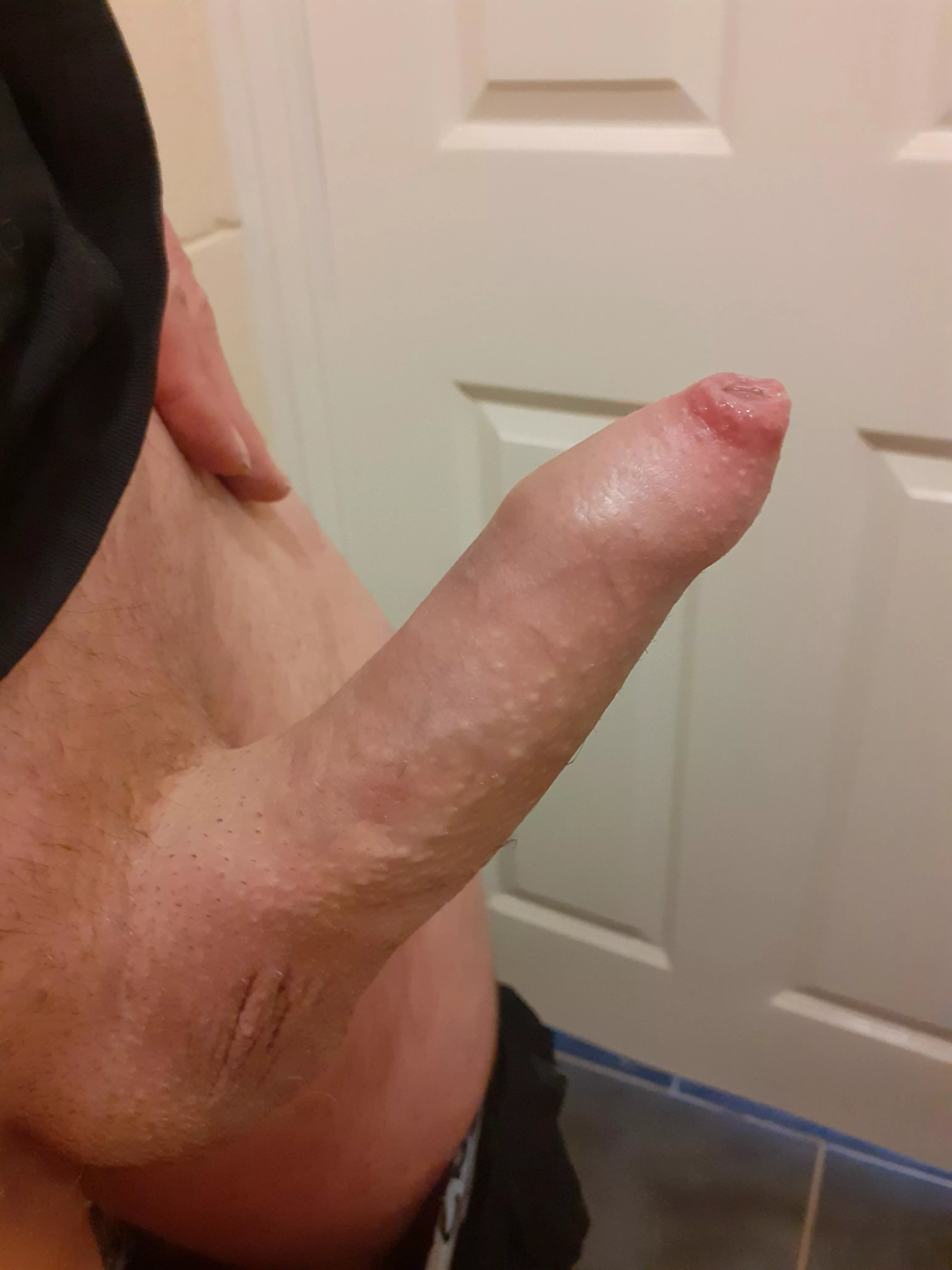 Any love for a tight foreskin (31)