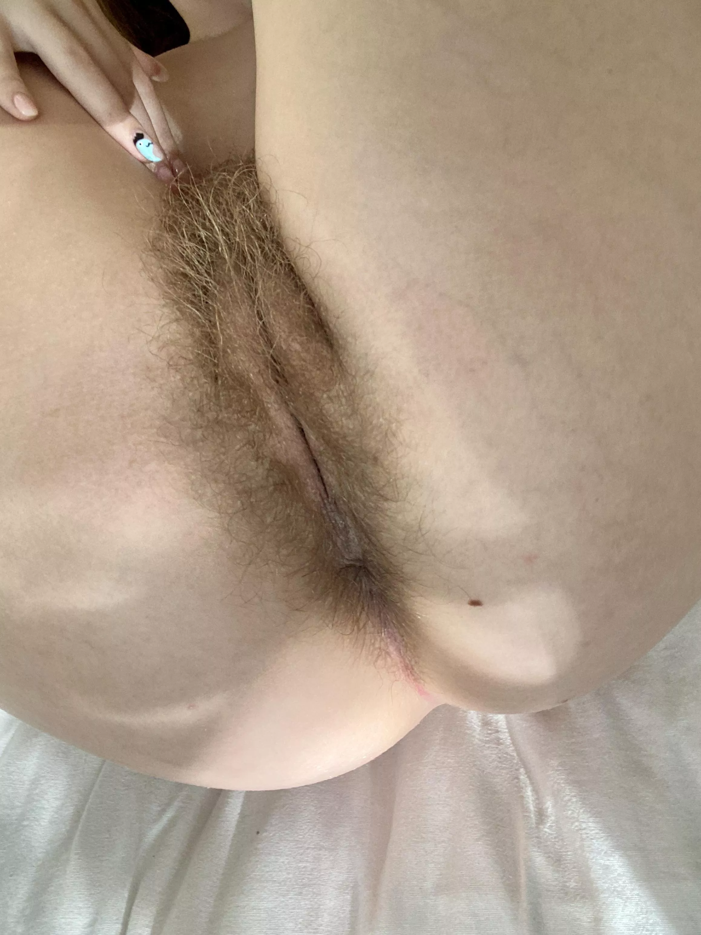 Are my lips very hairy?