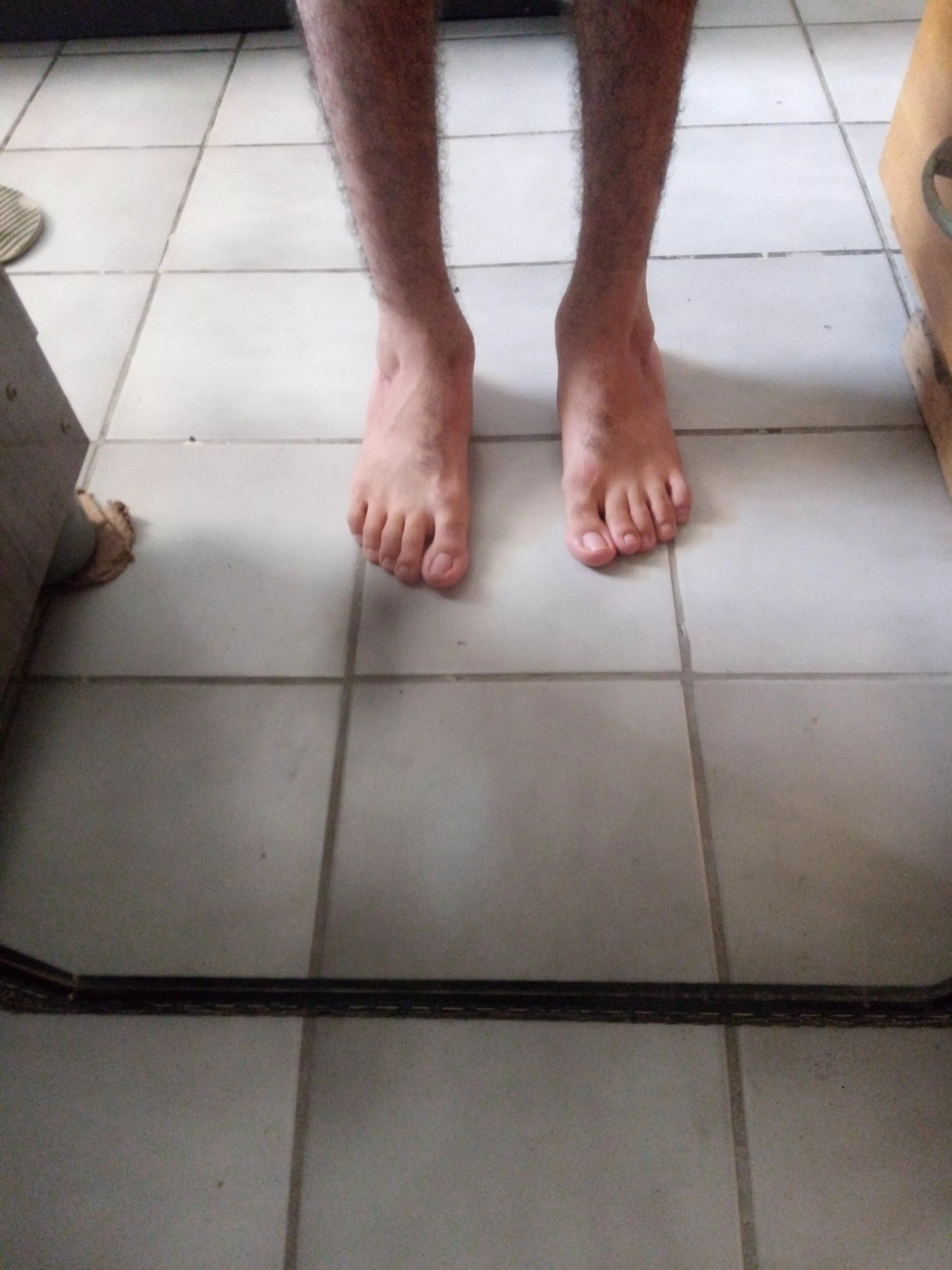 Are there people who have fetish for deformed feet? So I could make money off the part of my body i hate the most ðŸ¤·