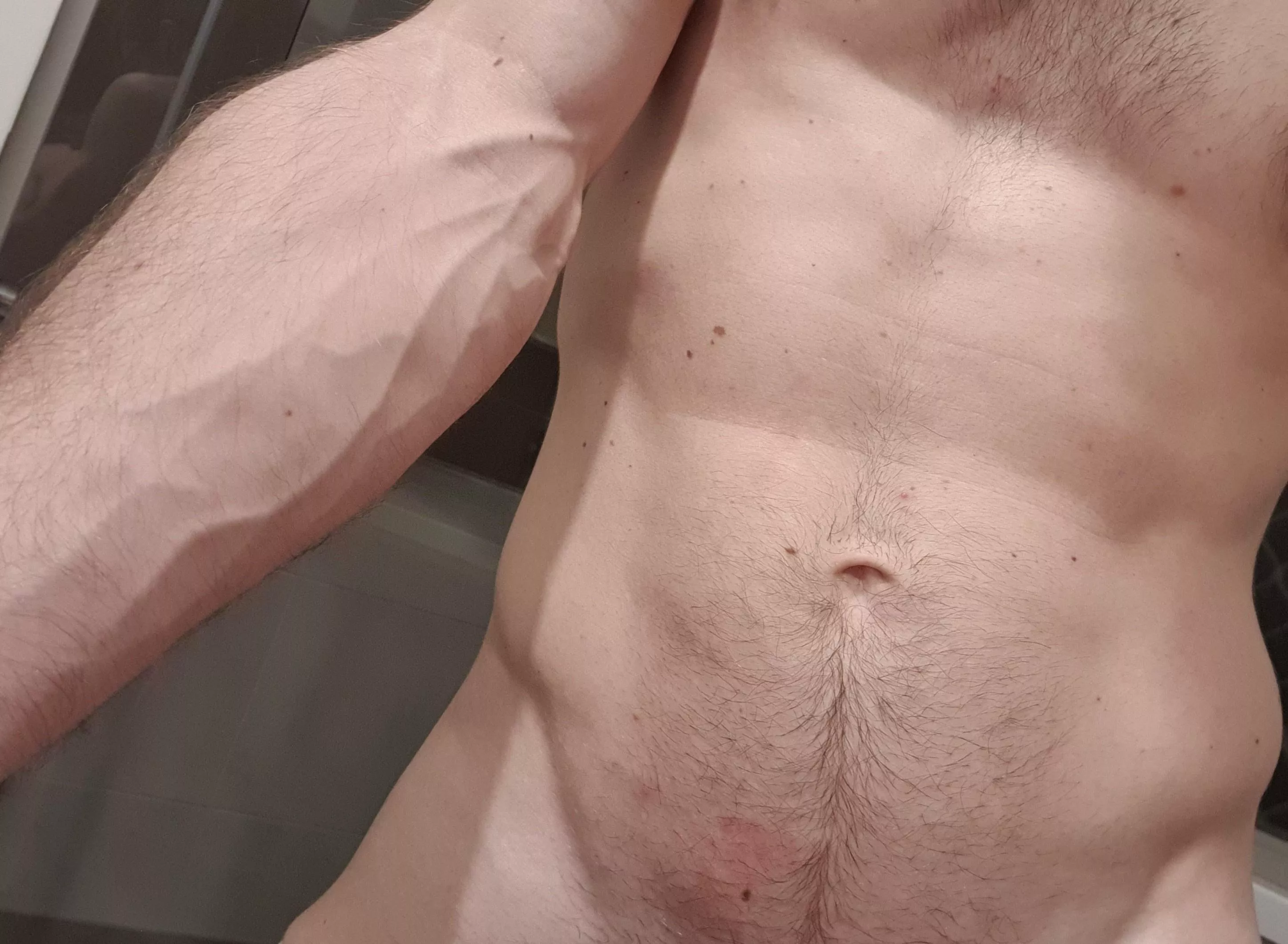 Bit of arm vein bulge post gy[m] session