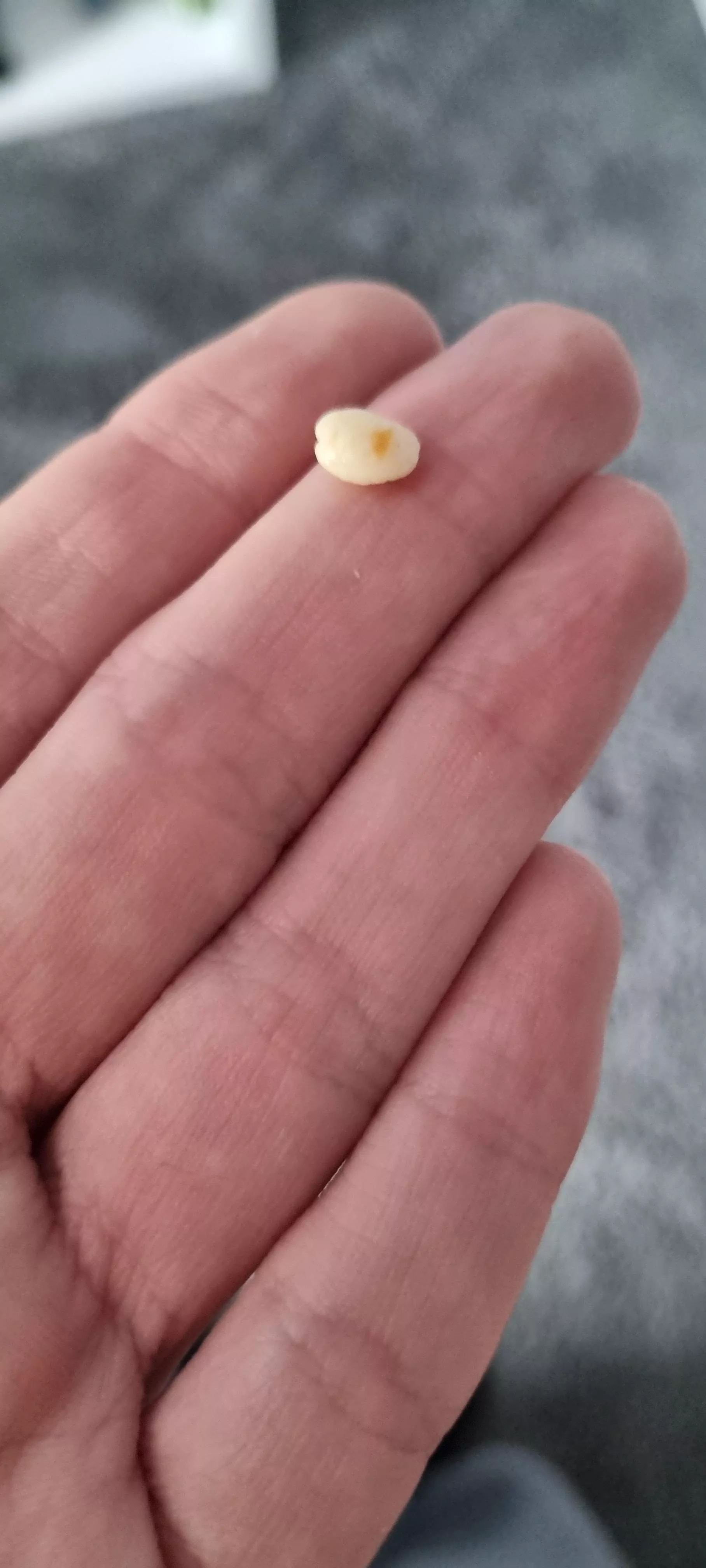 Coughed this little mf up, don't know if it counts