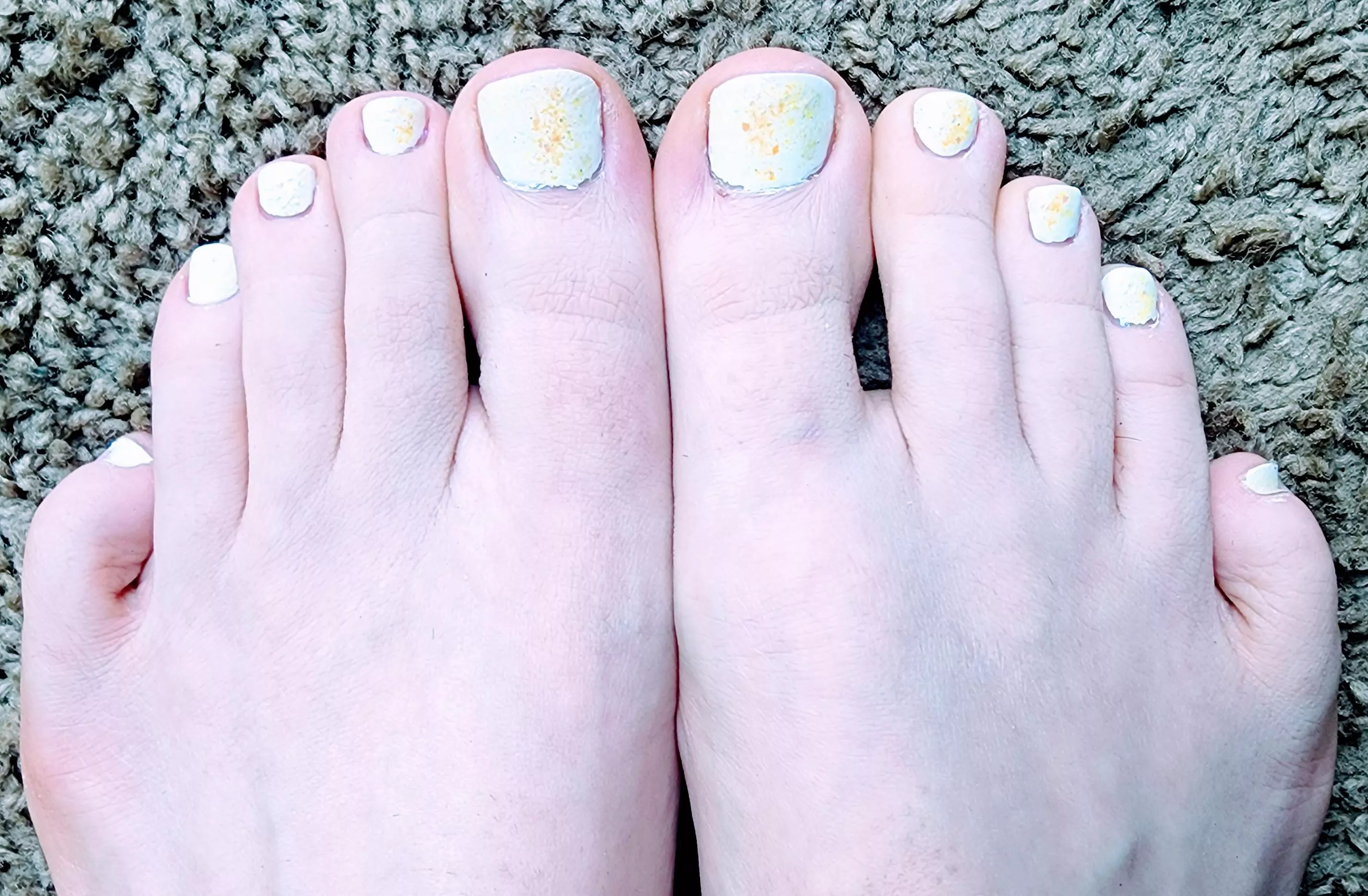 Do you like my white milky pedicure with blue glitter sparkle?? ðŸ‘£â¤ï¸ðŸ’… funfeetxxx