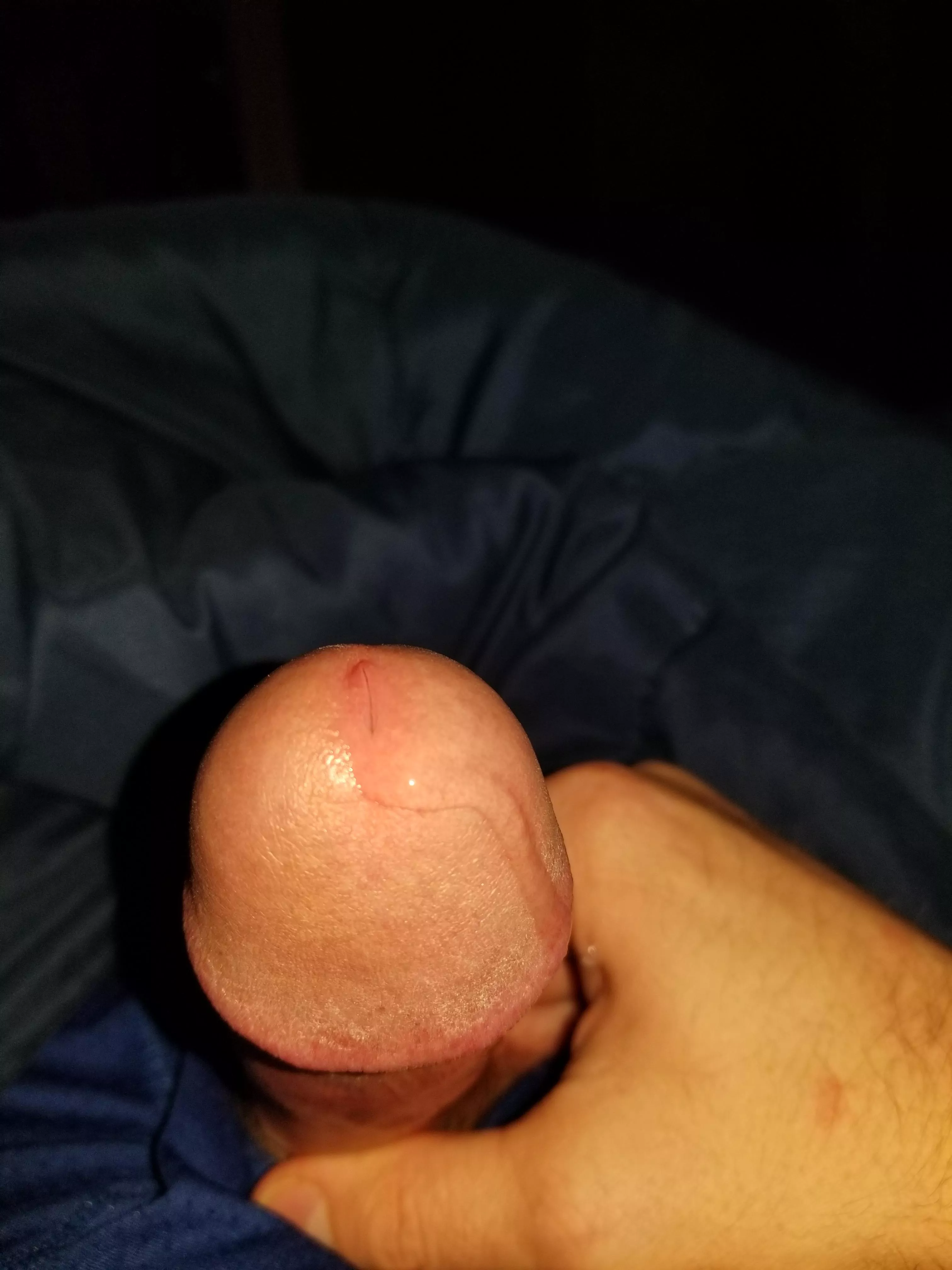 Edging and leaking