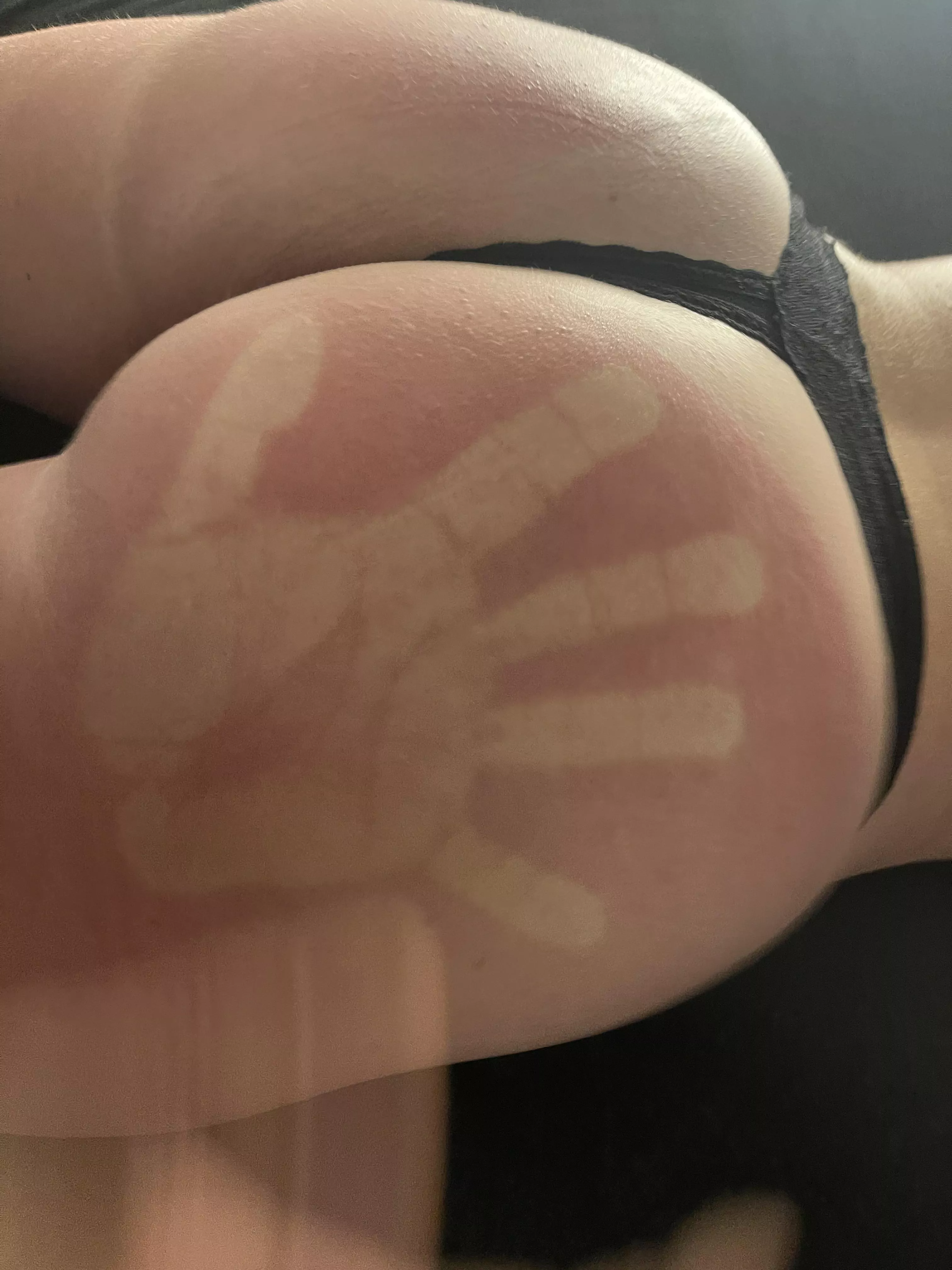 (F) I prefer when my ass is red with a handprintâ€¦. Not the other way around ðŸ™„