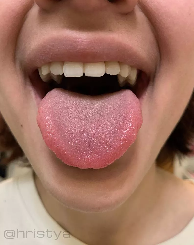 f19. rate my tongue please.