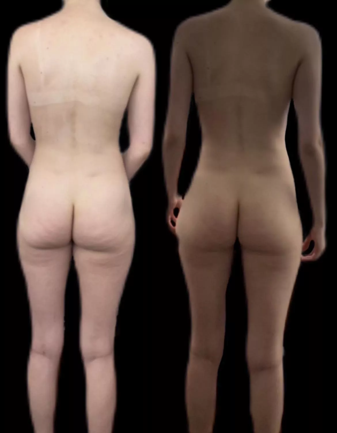 F23/5â€™9/138 - direct light standing naturally vs indirect light w/ slight pelvic tilt, feet farther apart & shoulders back