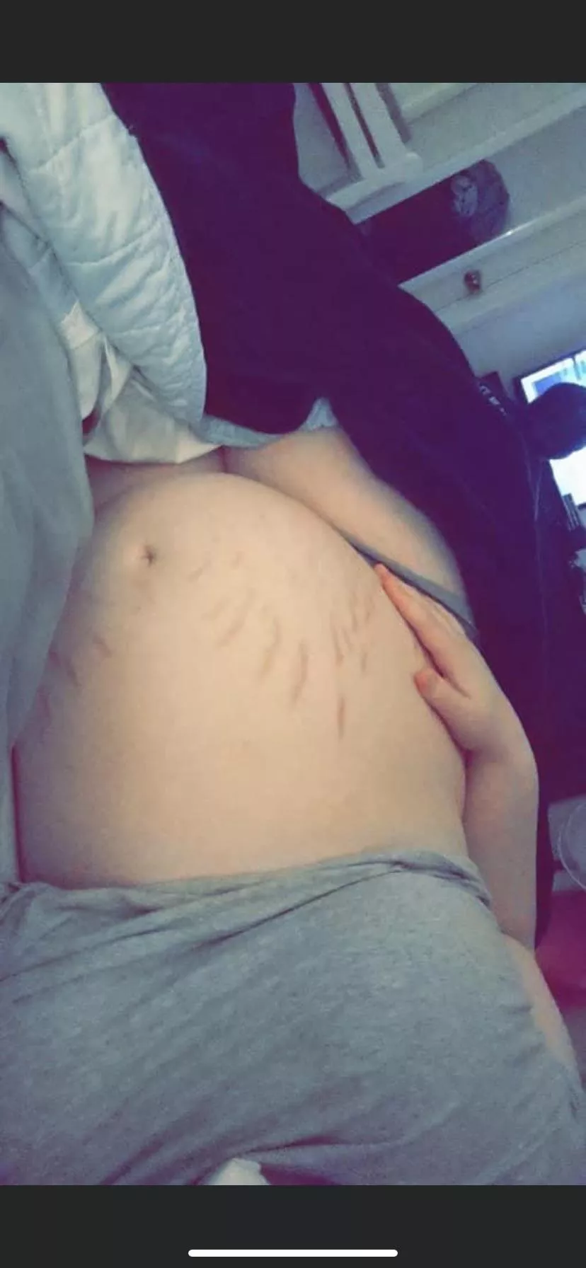 First real belly pic, do you guys like my stretch marks?