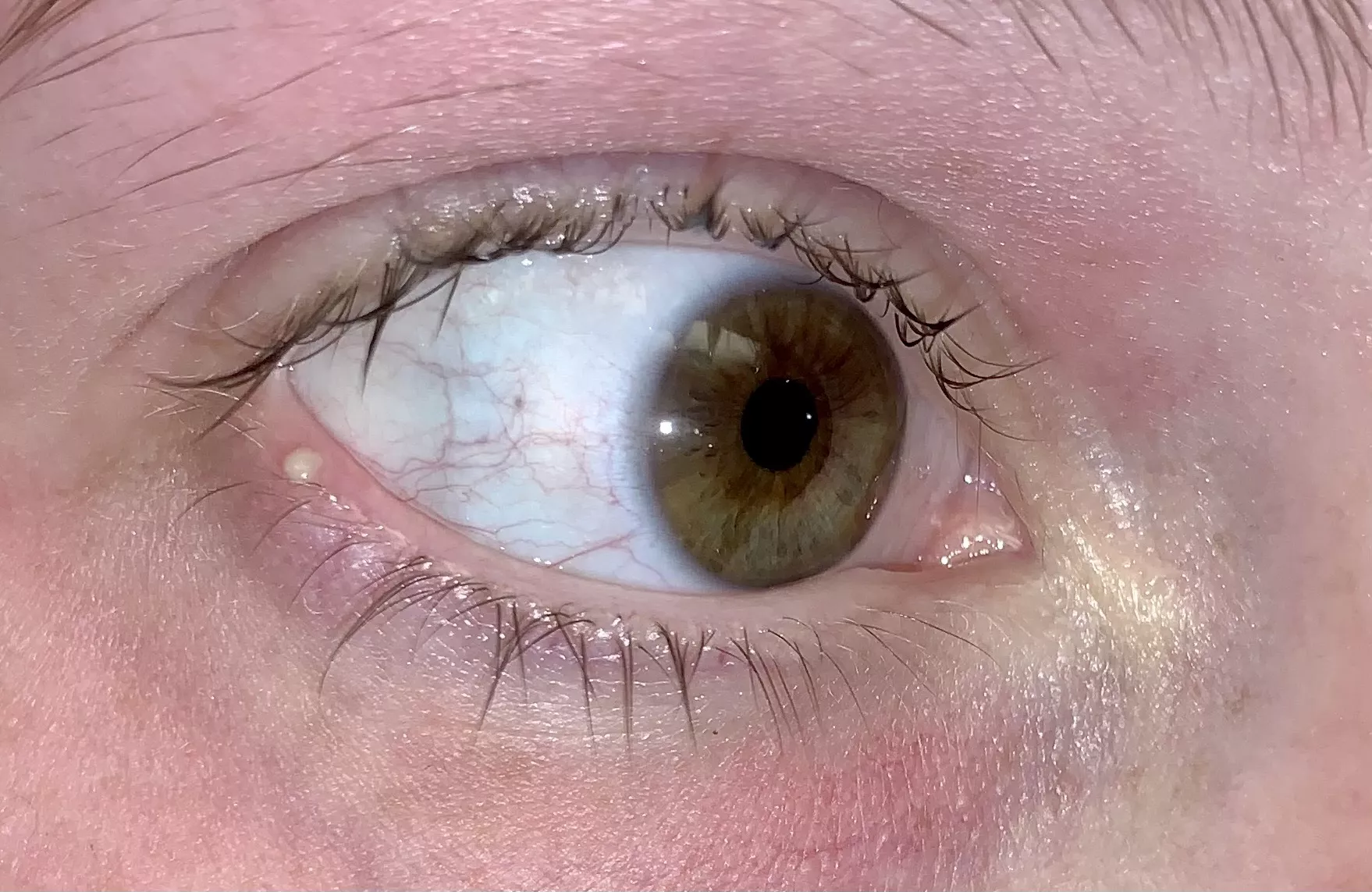 First stye I’ve ever had - so tempted to pop it