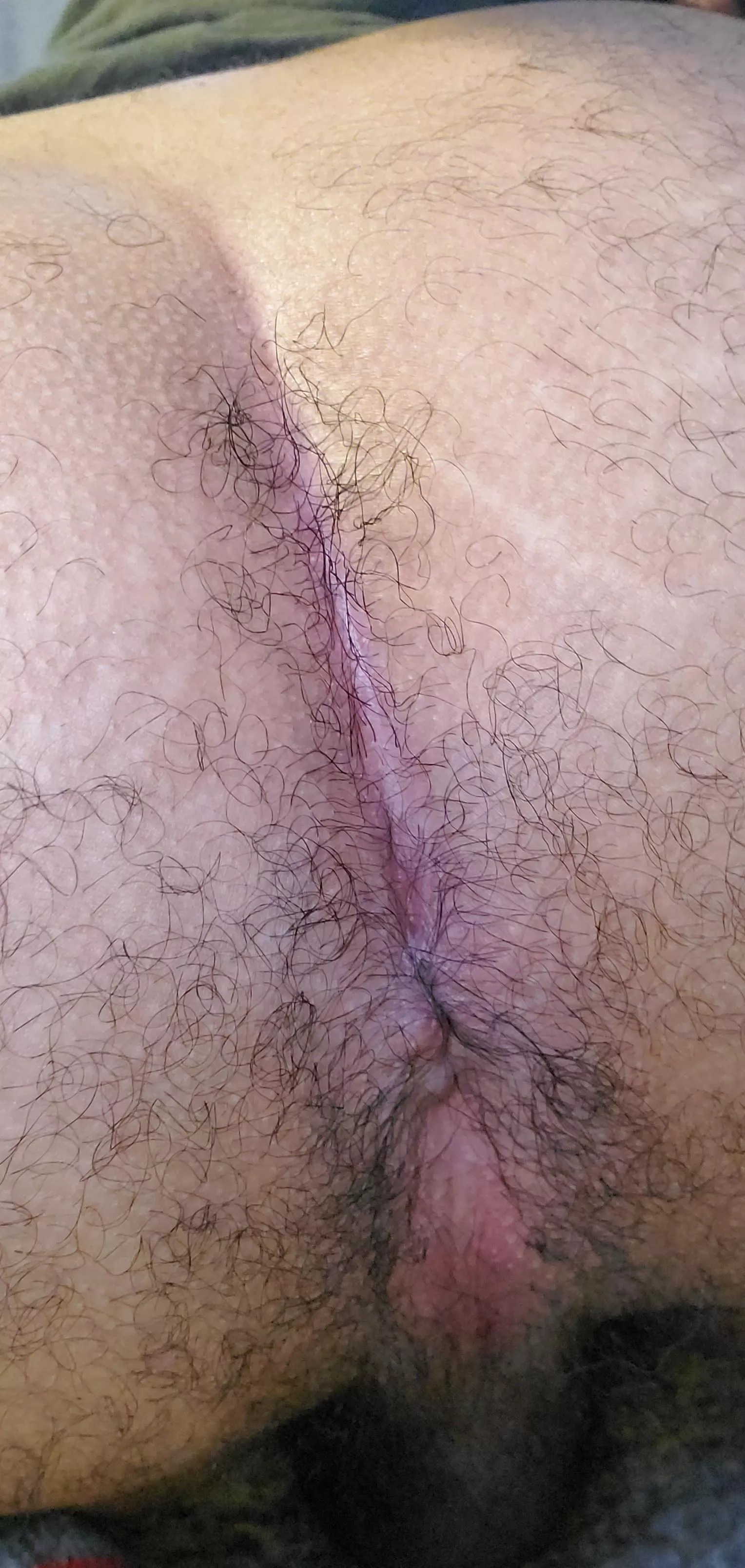 first time posting a hole pic is this hairy enough