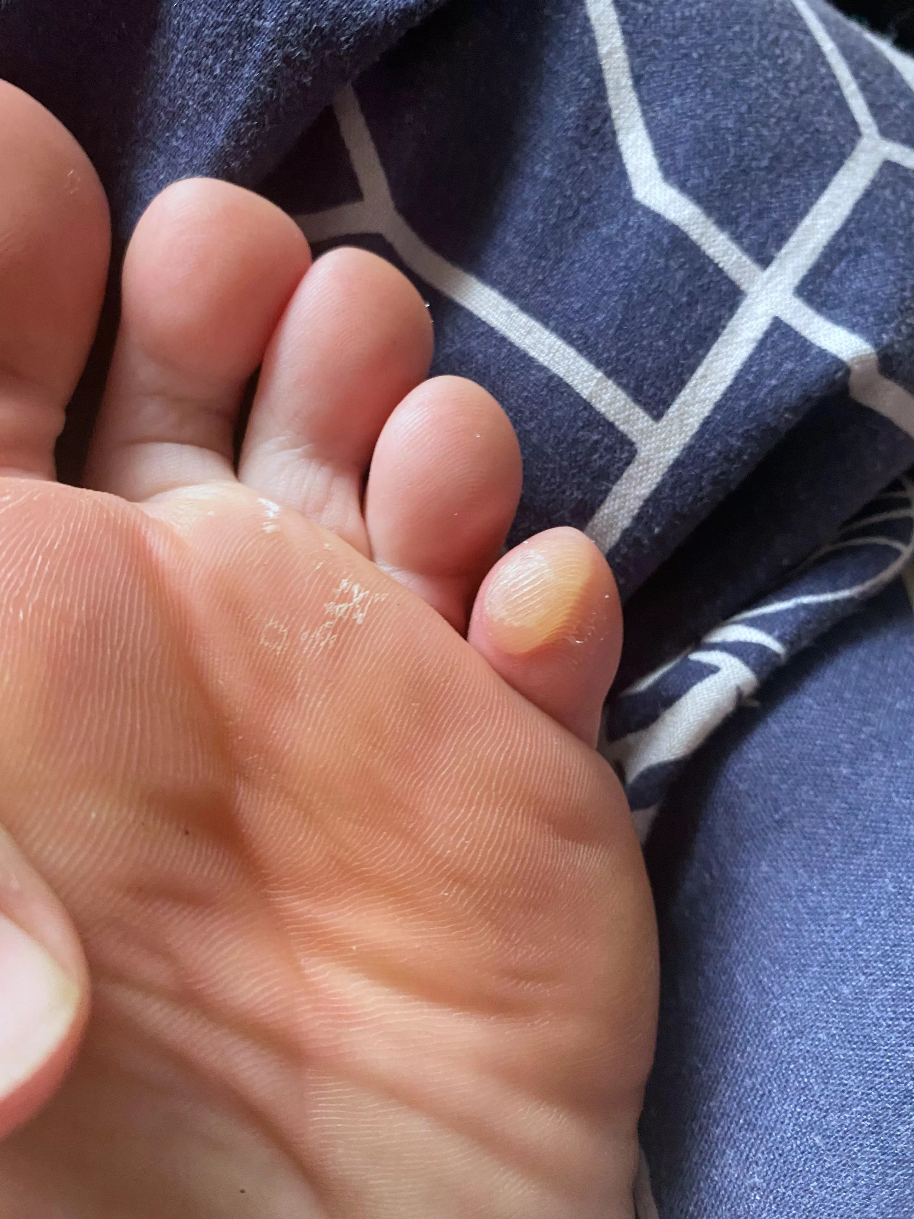 Forbidden pop from an 18km walk this weekend!