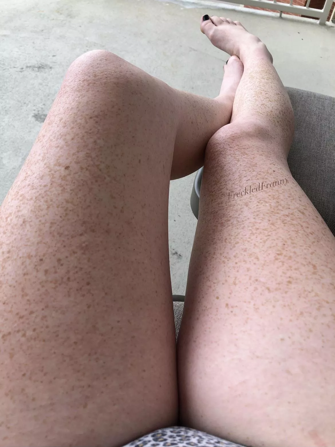 Freckled legs