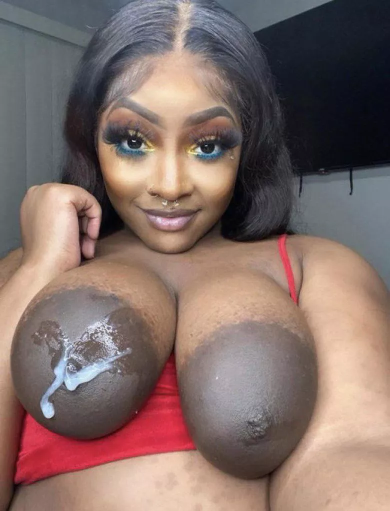 Giant areolas