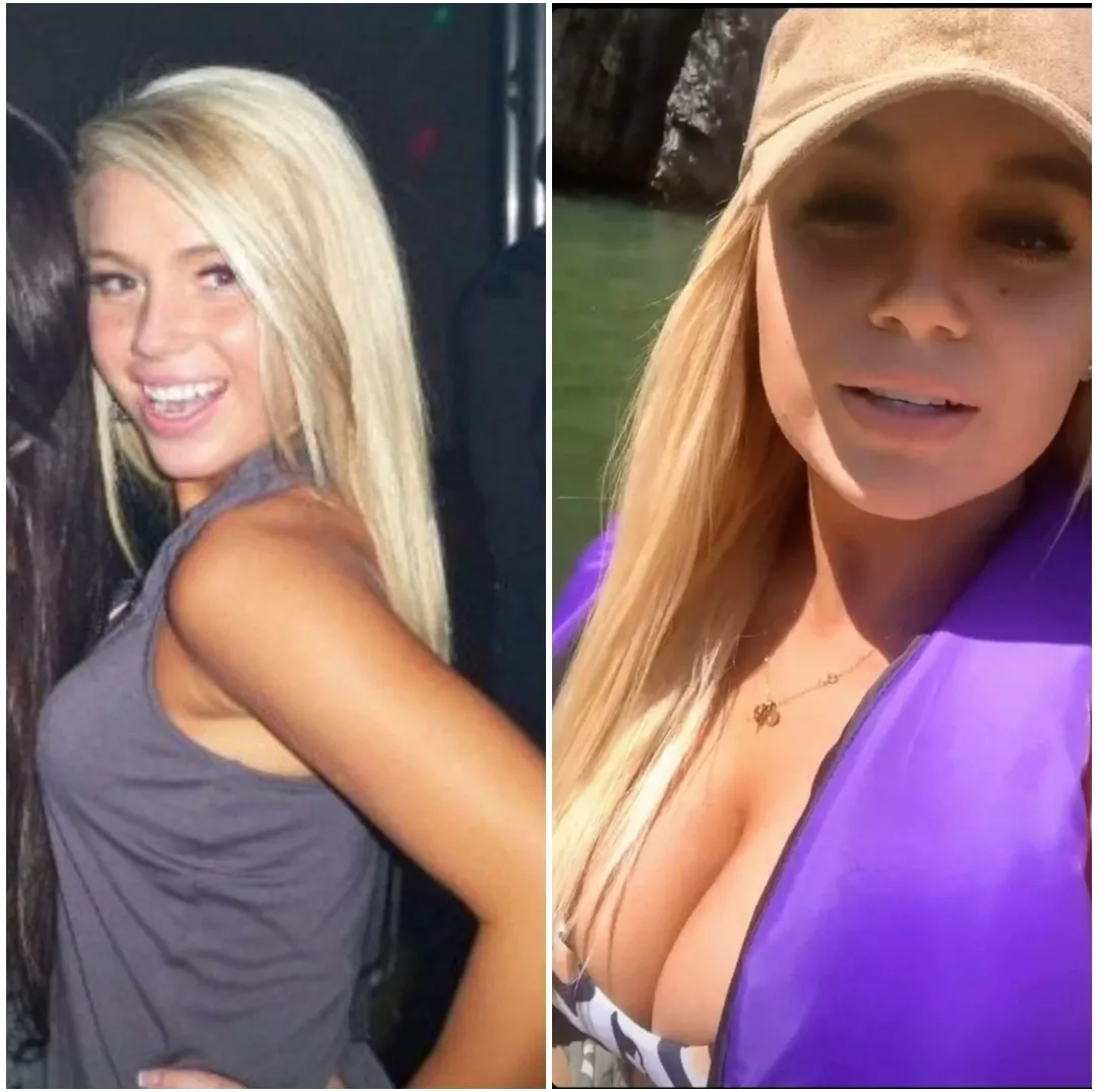 girl went from skinny b cups to hair extensions, fake tits and more guys than you can count.