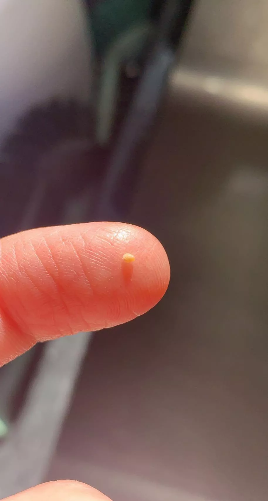 Got this big ass egg pulled out of my ear