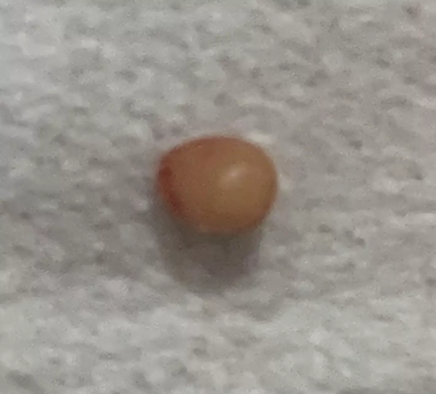 Had this cyst for around six months- after a lot of patience and some self surgery, I got it out in one piece!