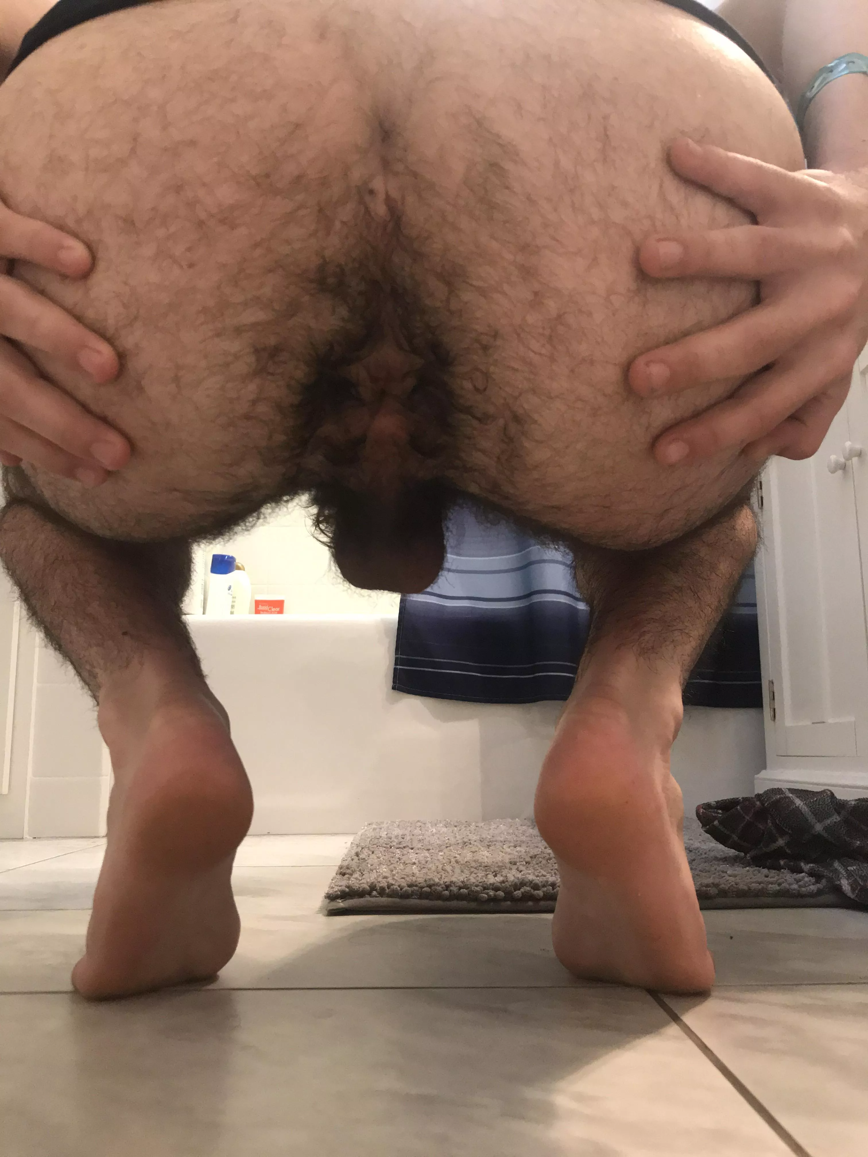 Hairy rGeek hole