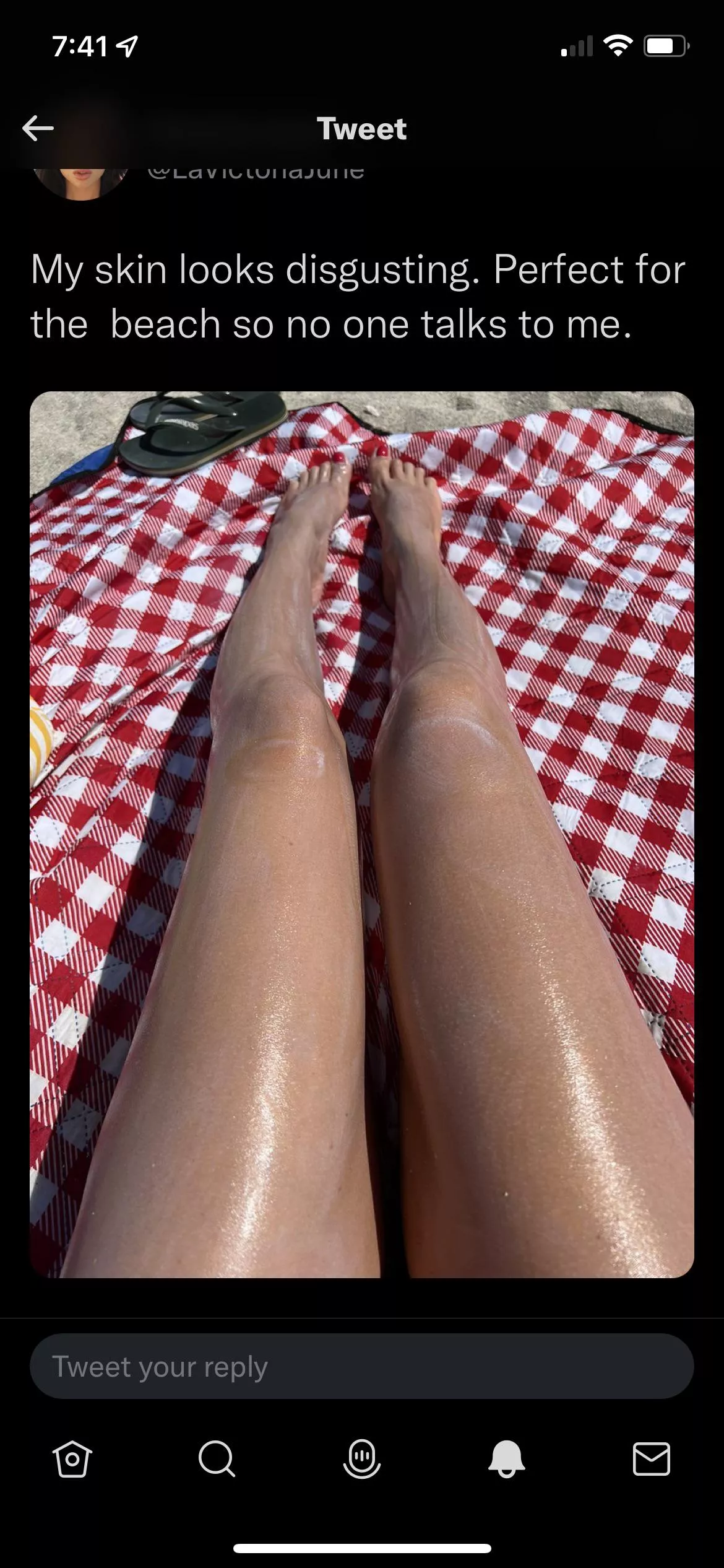 Her legs look like frozen hot dogs