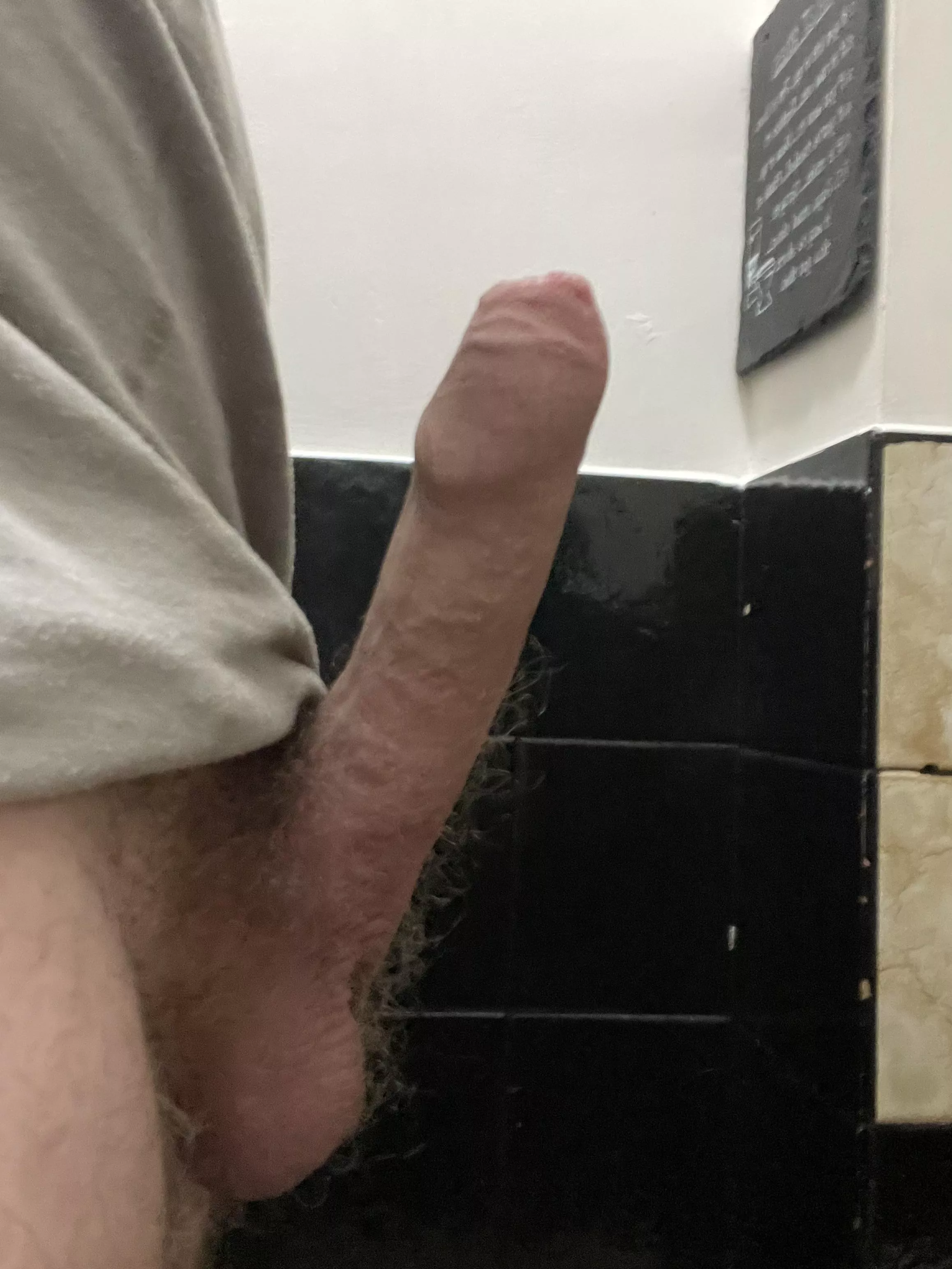 Hi, not sure if this is the right place, but want opinions, and to know who else’s penis goes up this far, issues, good bad?