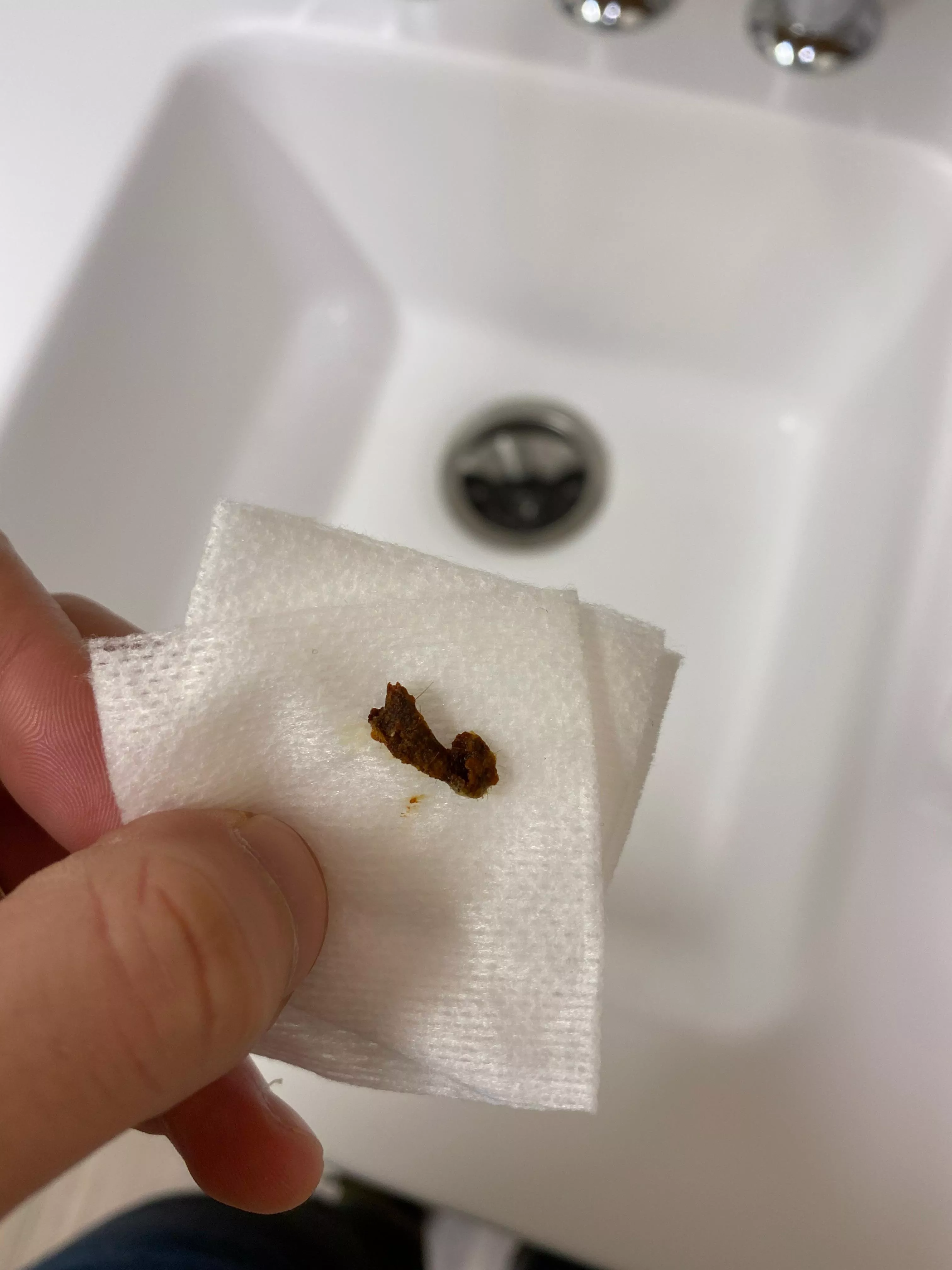 Impacted earwax removal