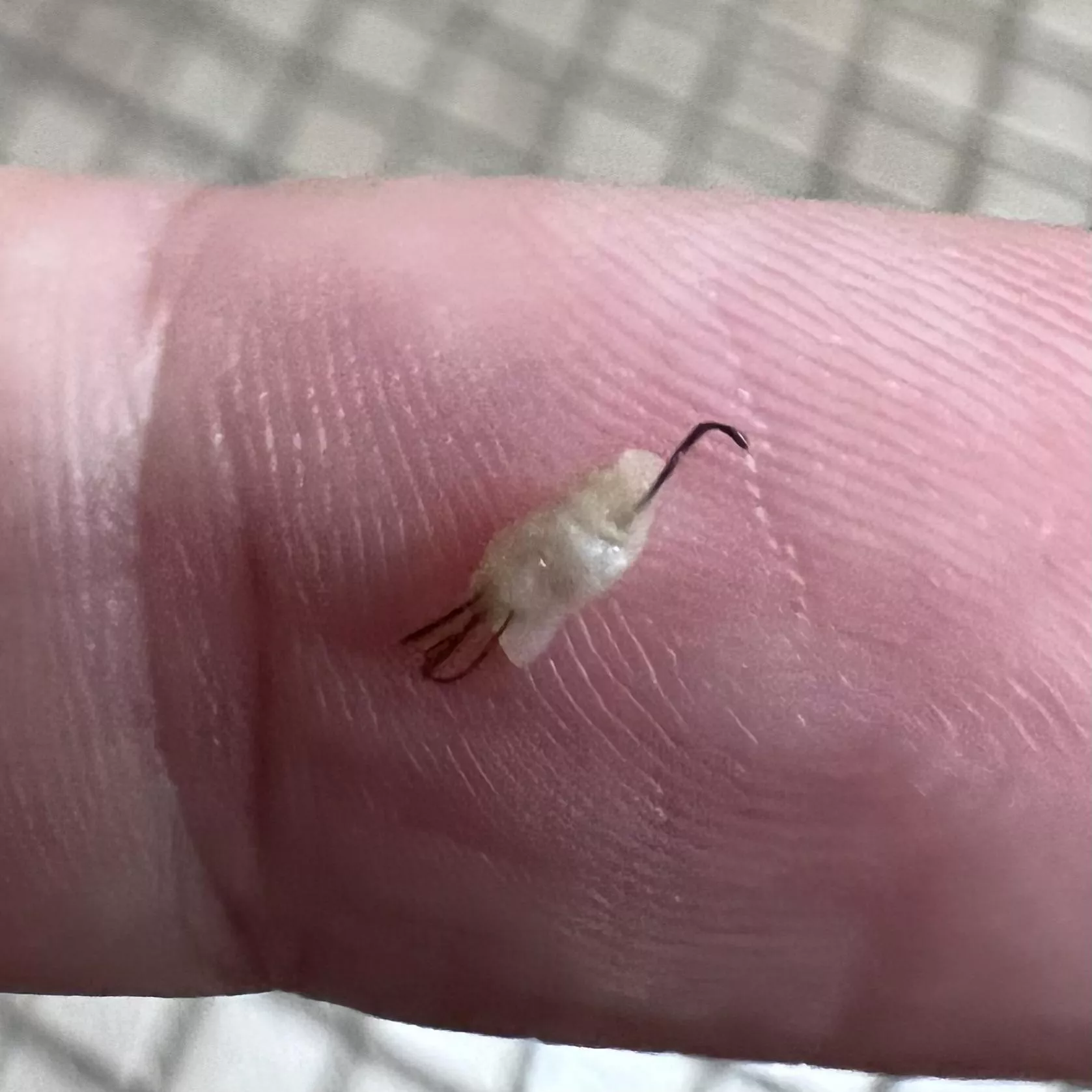 Ingrown pili multigemini ðŸ¤¢