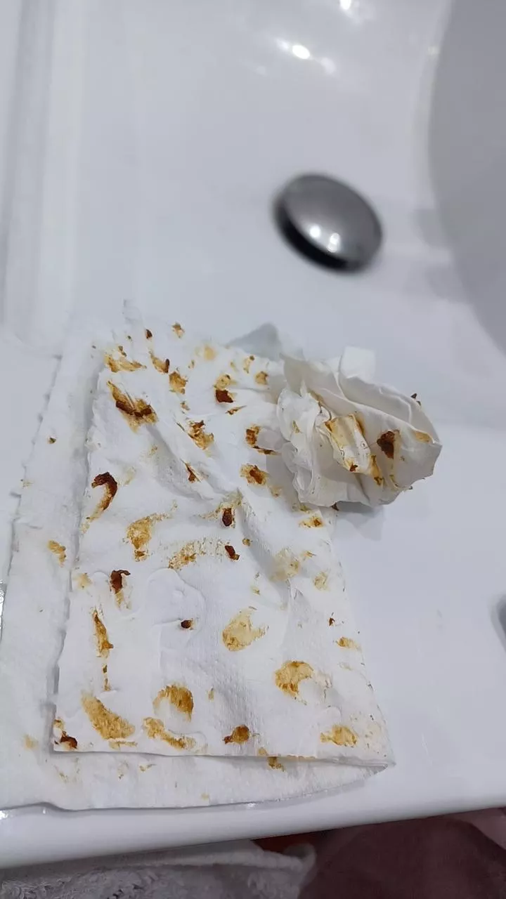 Insane earwax buildup. No idea why!