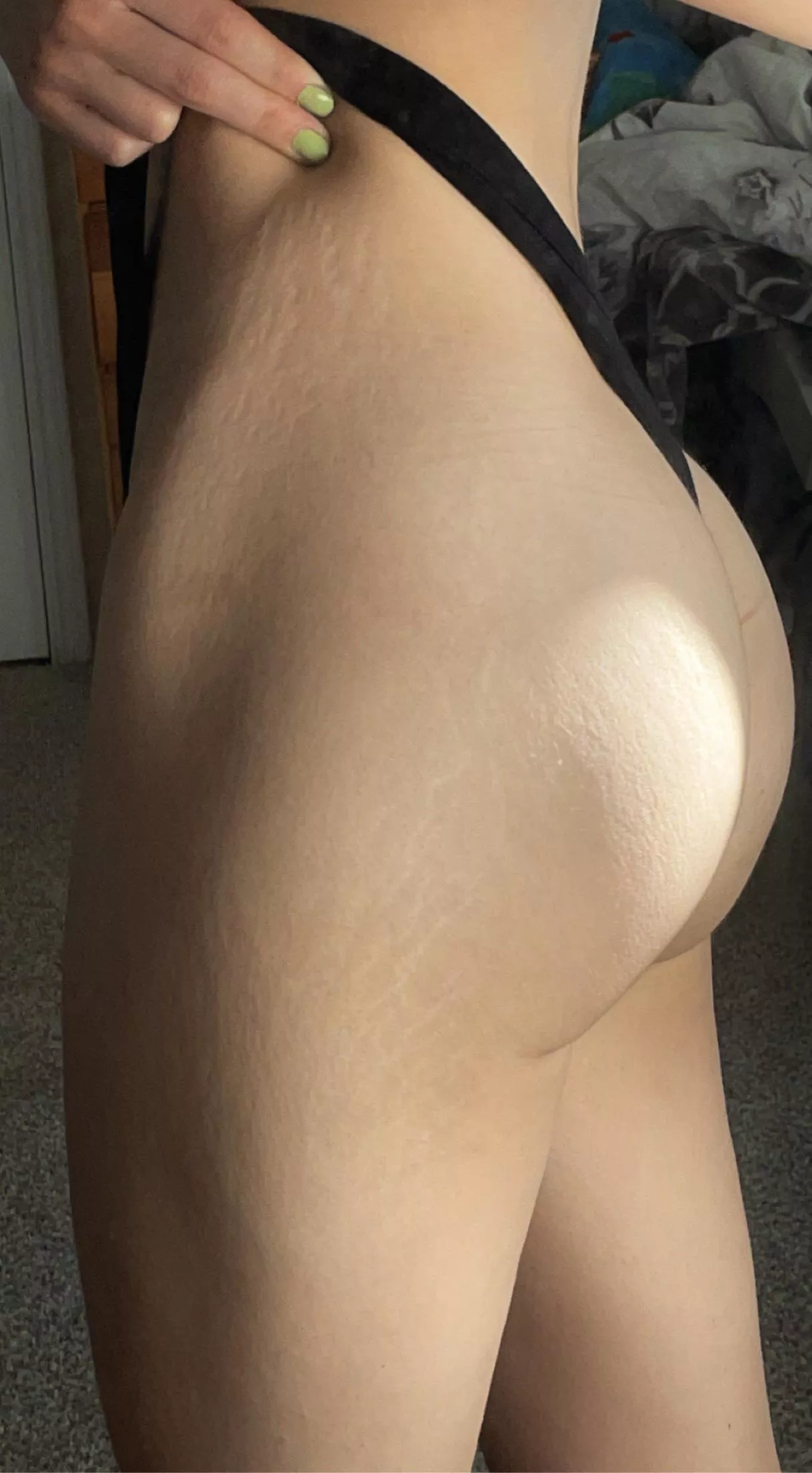 Is athletic booty with stretch marks loved here?