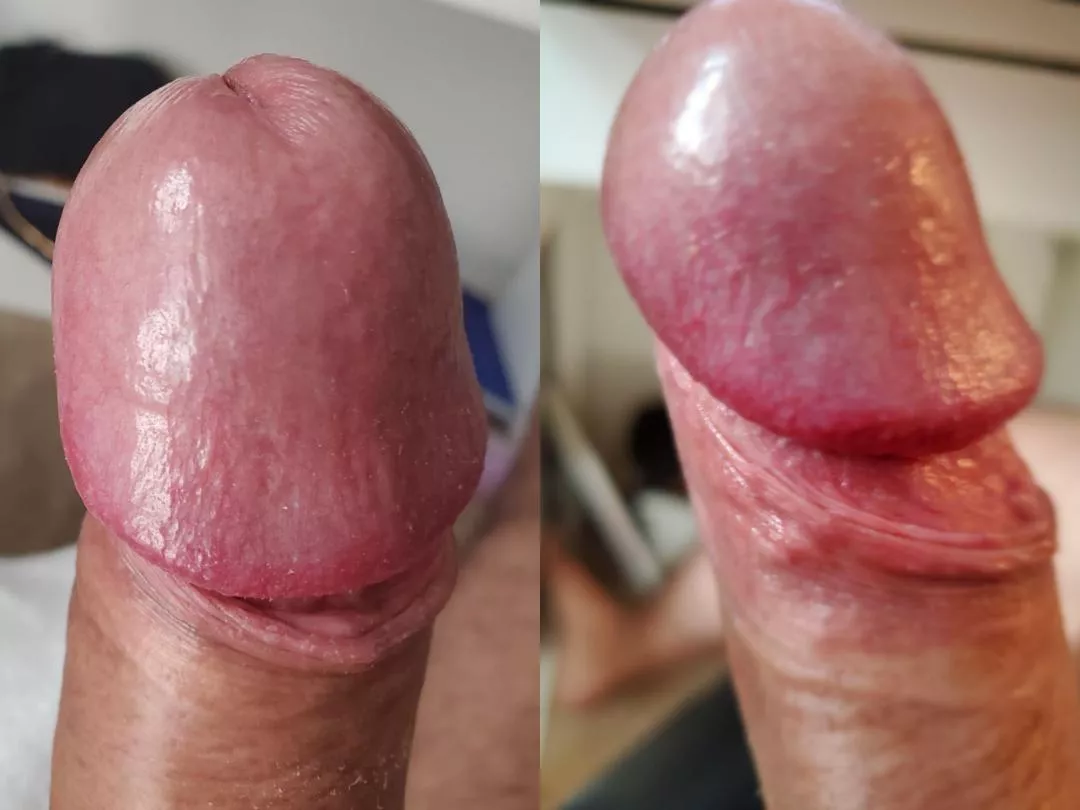 it feels so vulnerable have the head exposed! This is what my tip looks like when I pull down my foreskin. It's pretty photogenic!