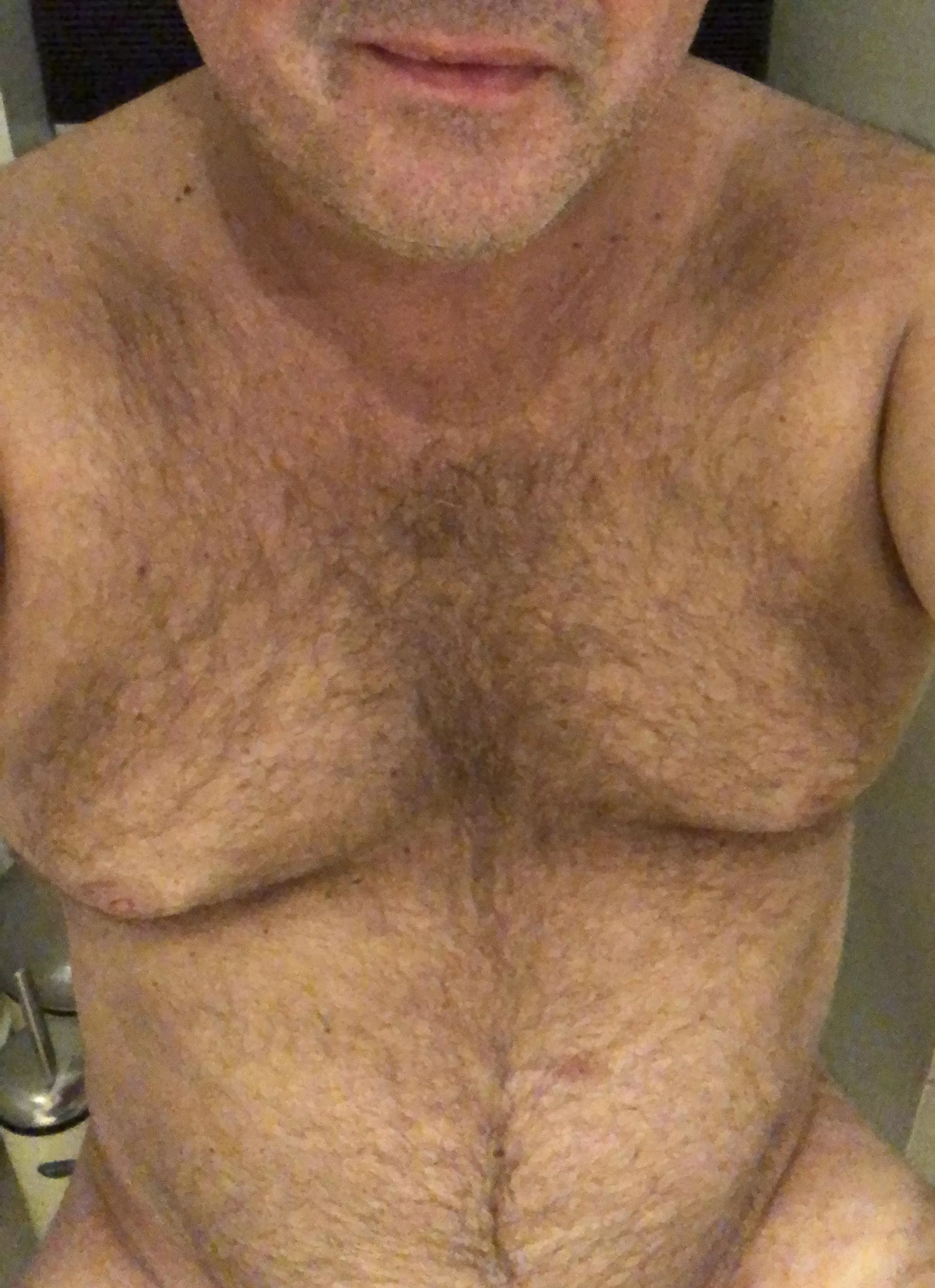 I’ve come to accept my hairy body :)