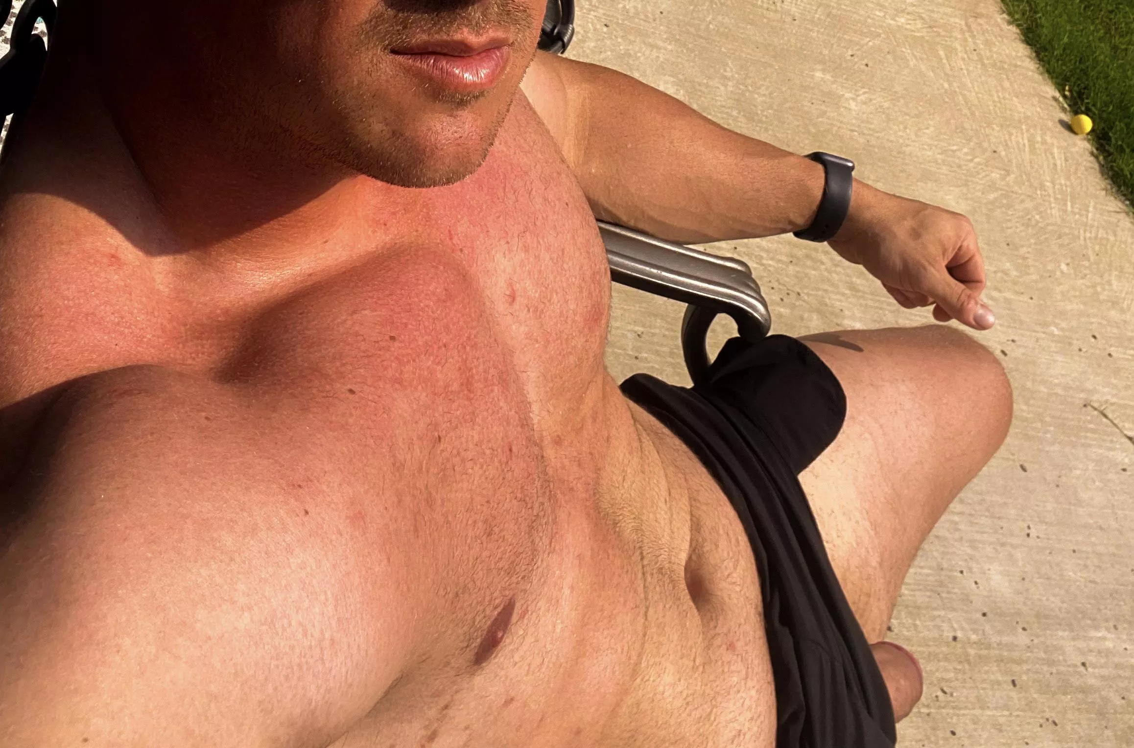 Just getting some sun [36]