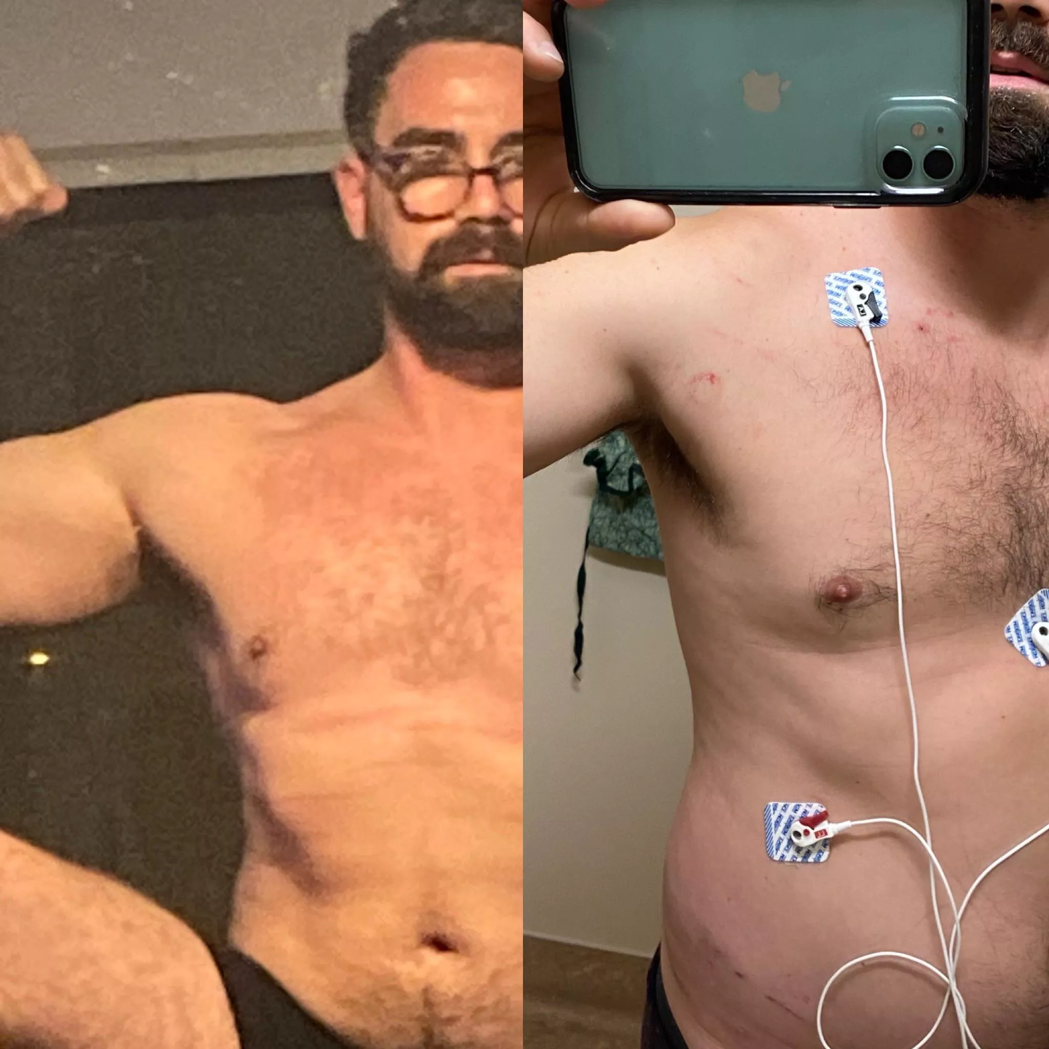 Last April I was in an accident and had to stay in the hospital. Now I’m back to lifting weights and on my road to recovery. M30