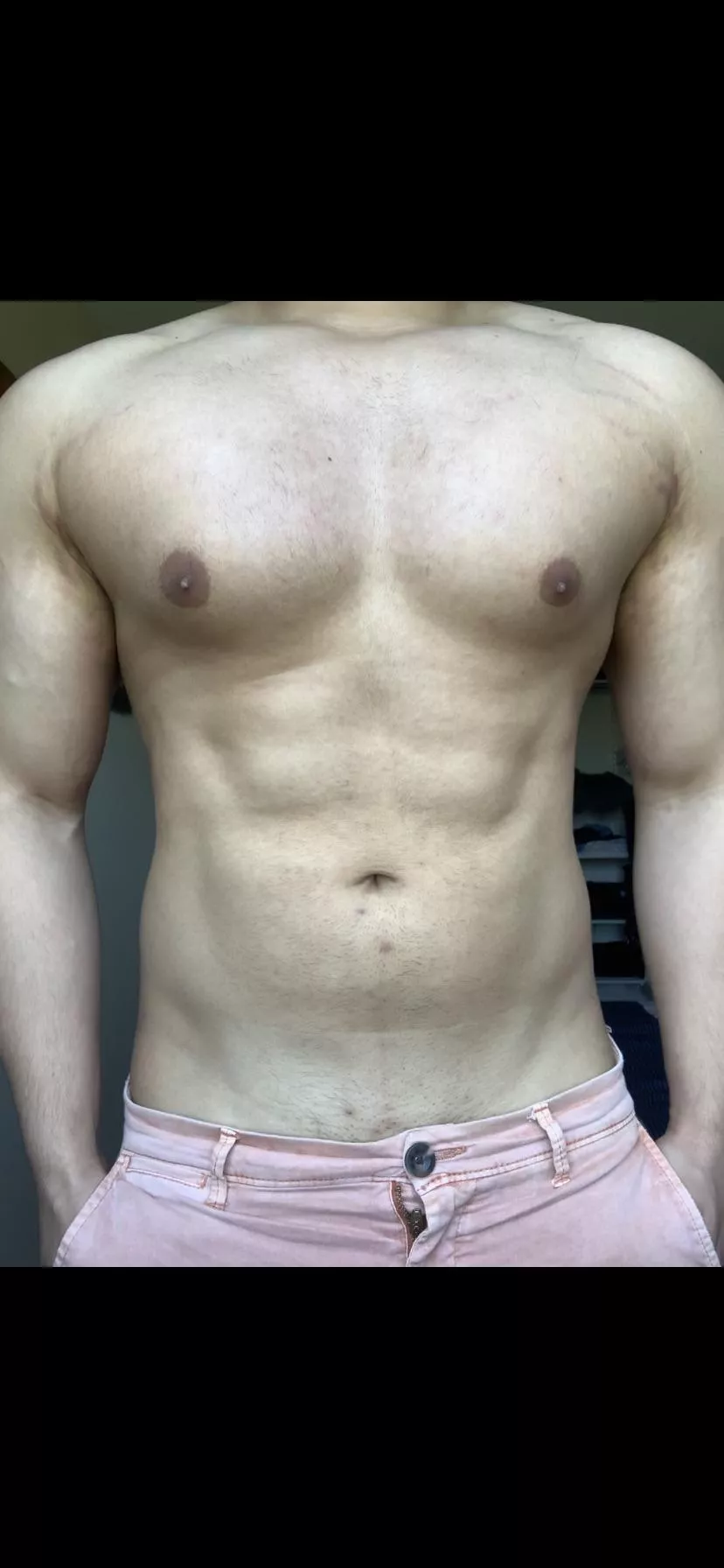 [m] Chest pump