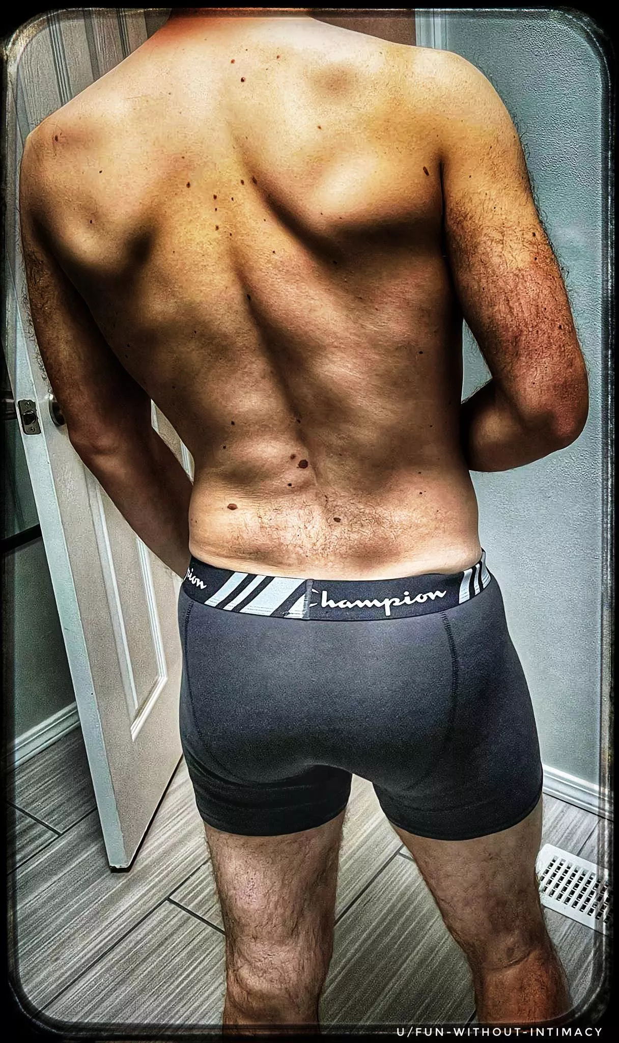 My backside needs so[m]e attention…