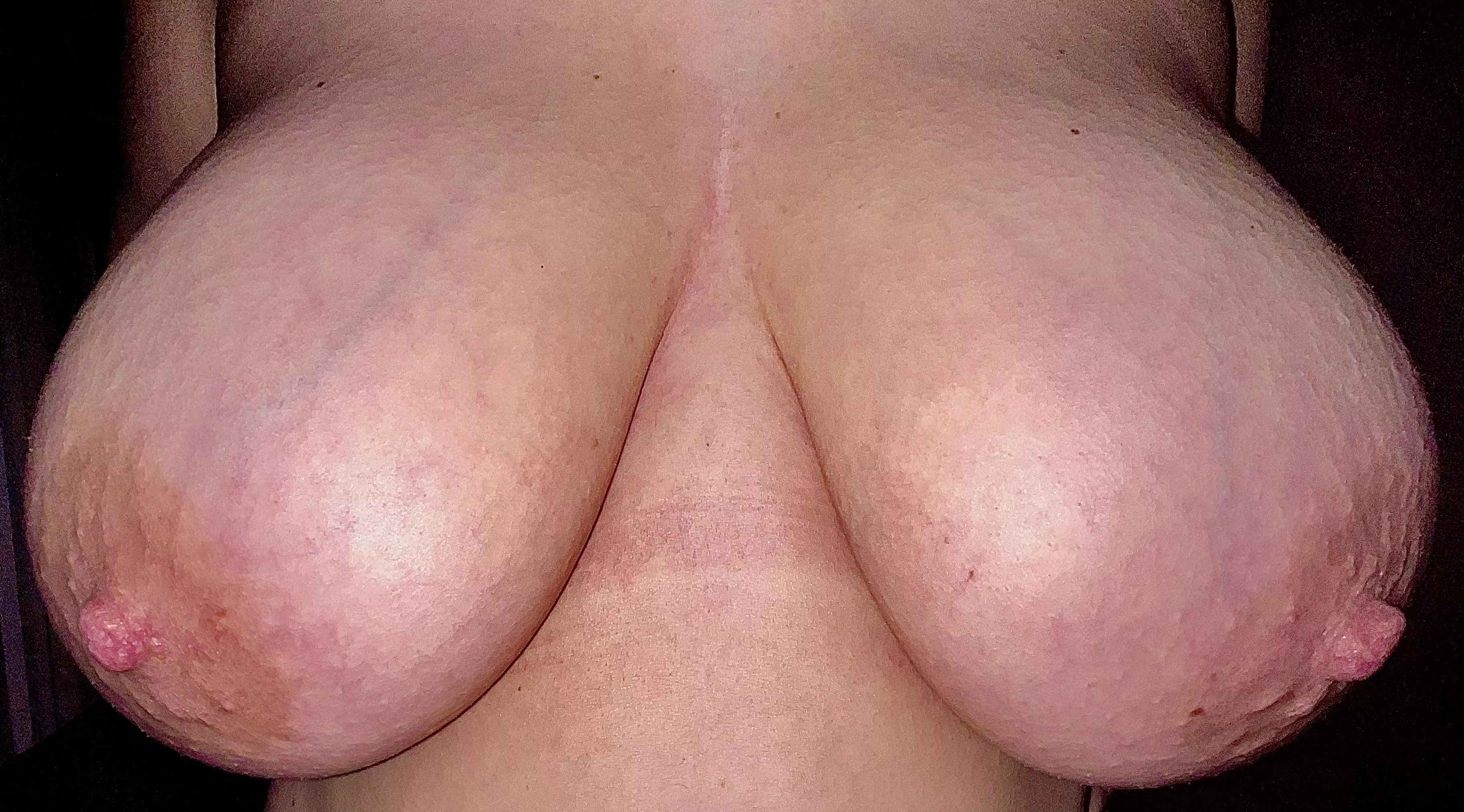 My big nipples are back!