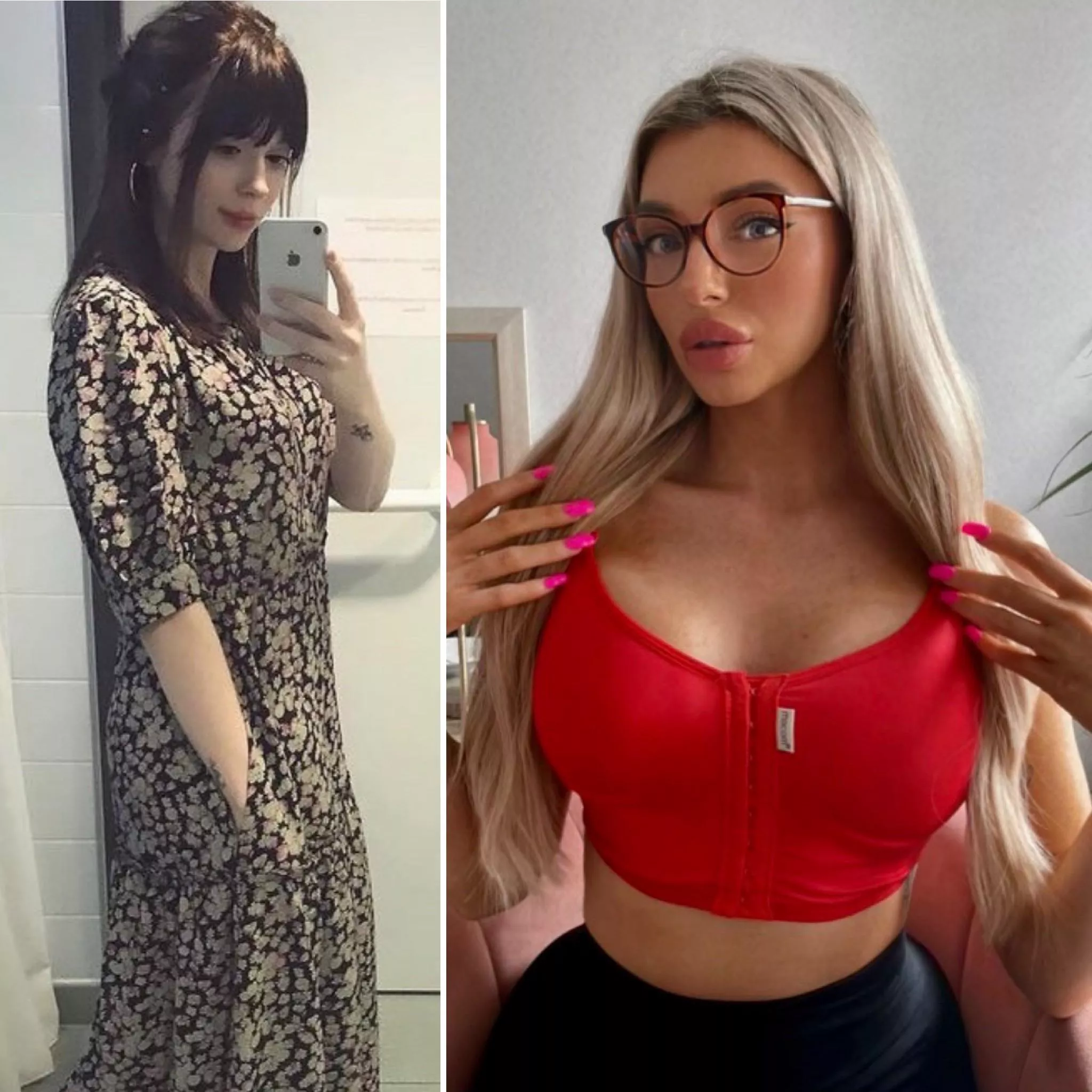 My bimbo transformation so far. New tits ✅ New lips ✅ New hair ✅ New nails ✅ New physique ✅ and more to come 🥰