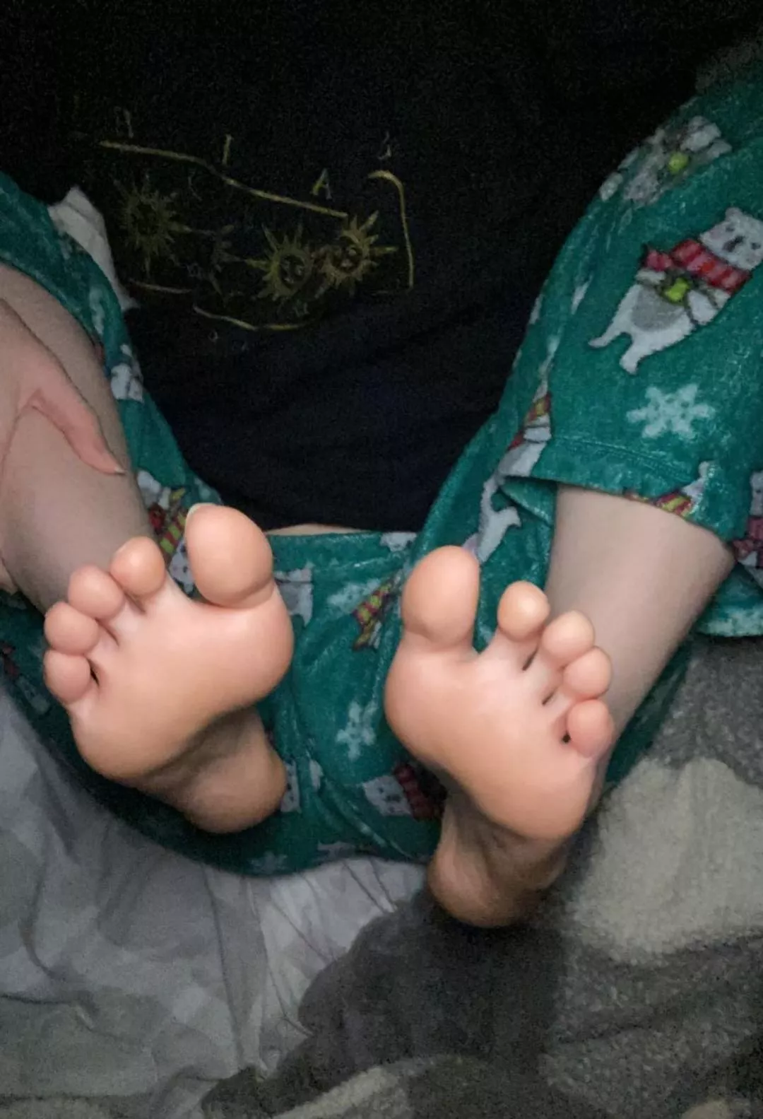 My (F18) best friends toes and soles, what do you guys think?