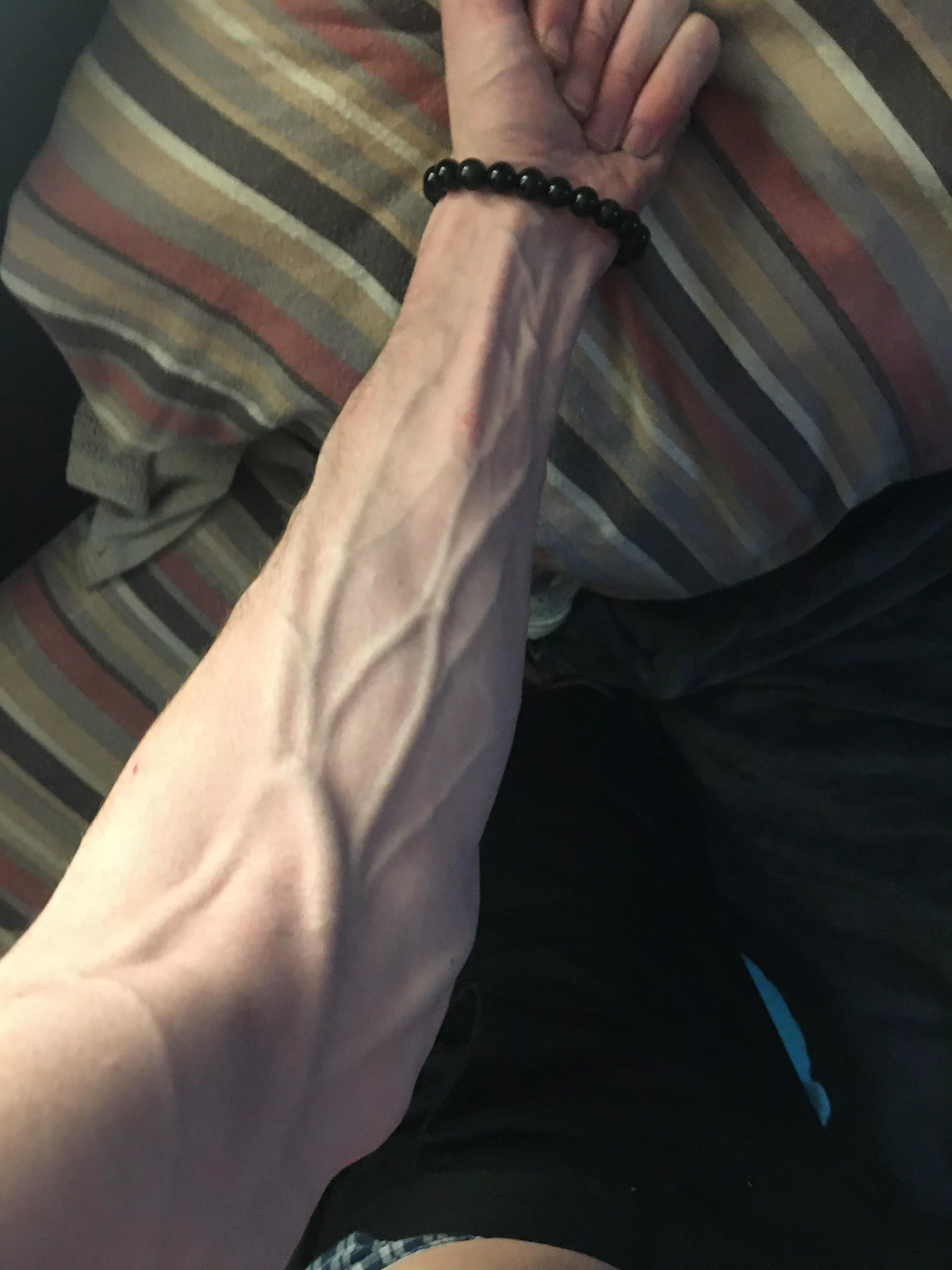 My forearms in their resting state