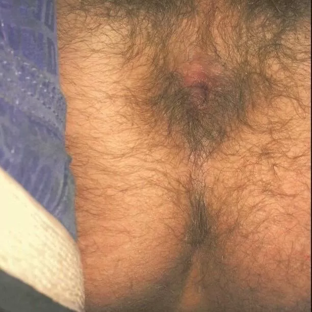 My hairy hole..