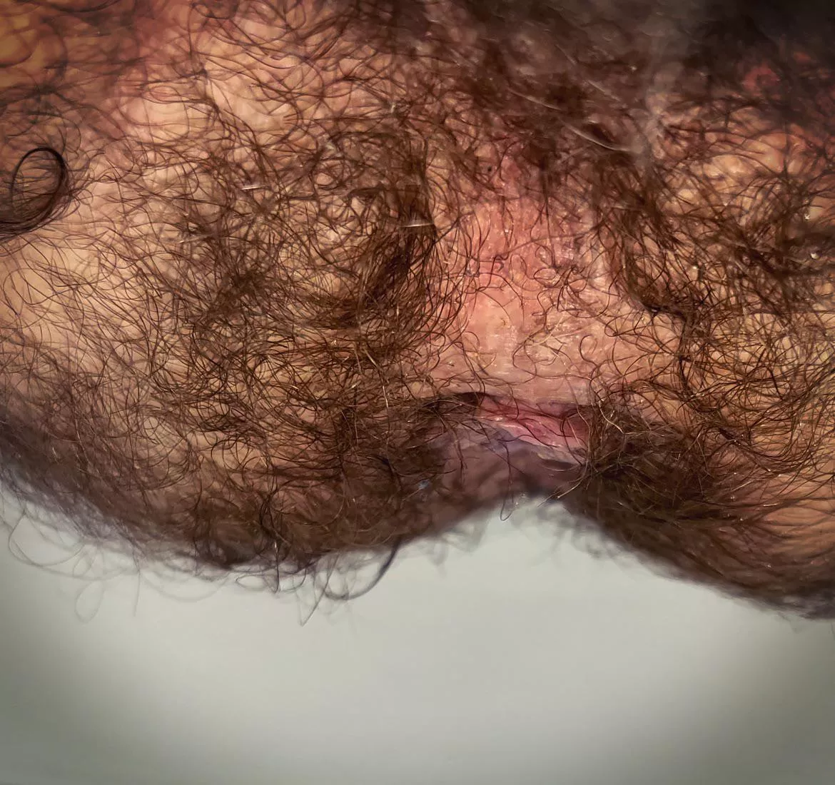 My hole and taint are so damn hairyâ€¦..