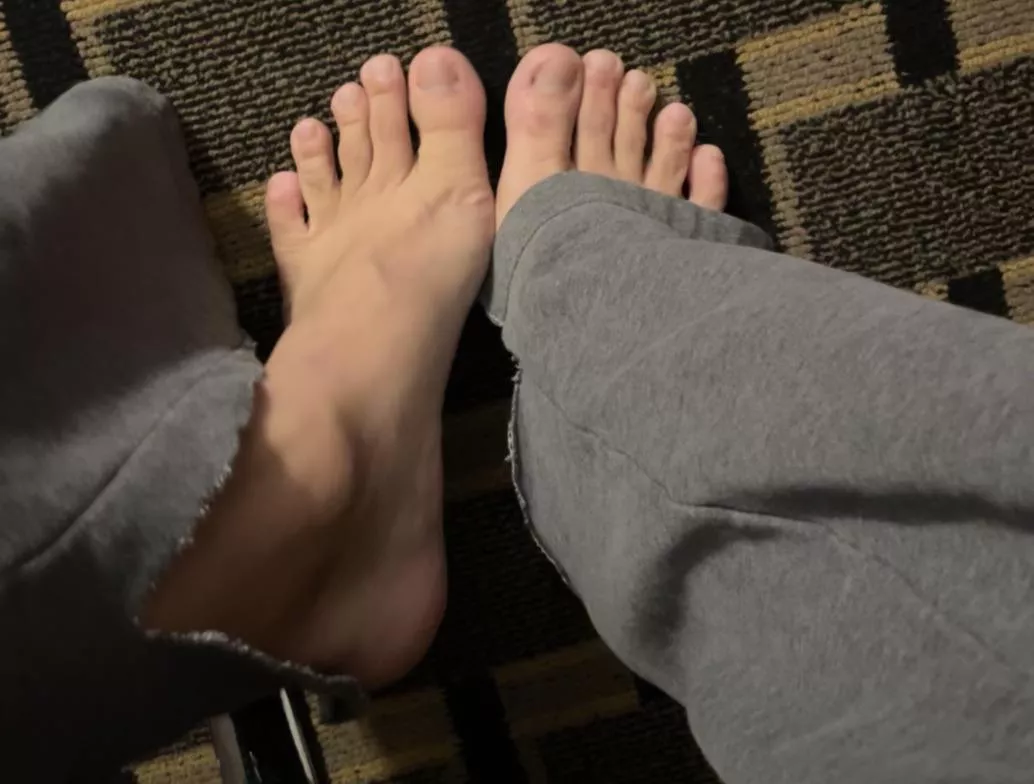 My hotel feet