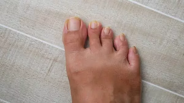 My long toenails